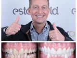 Nazorg door tandarts in NL