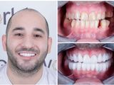 Superieure tandarts in Turkije