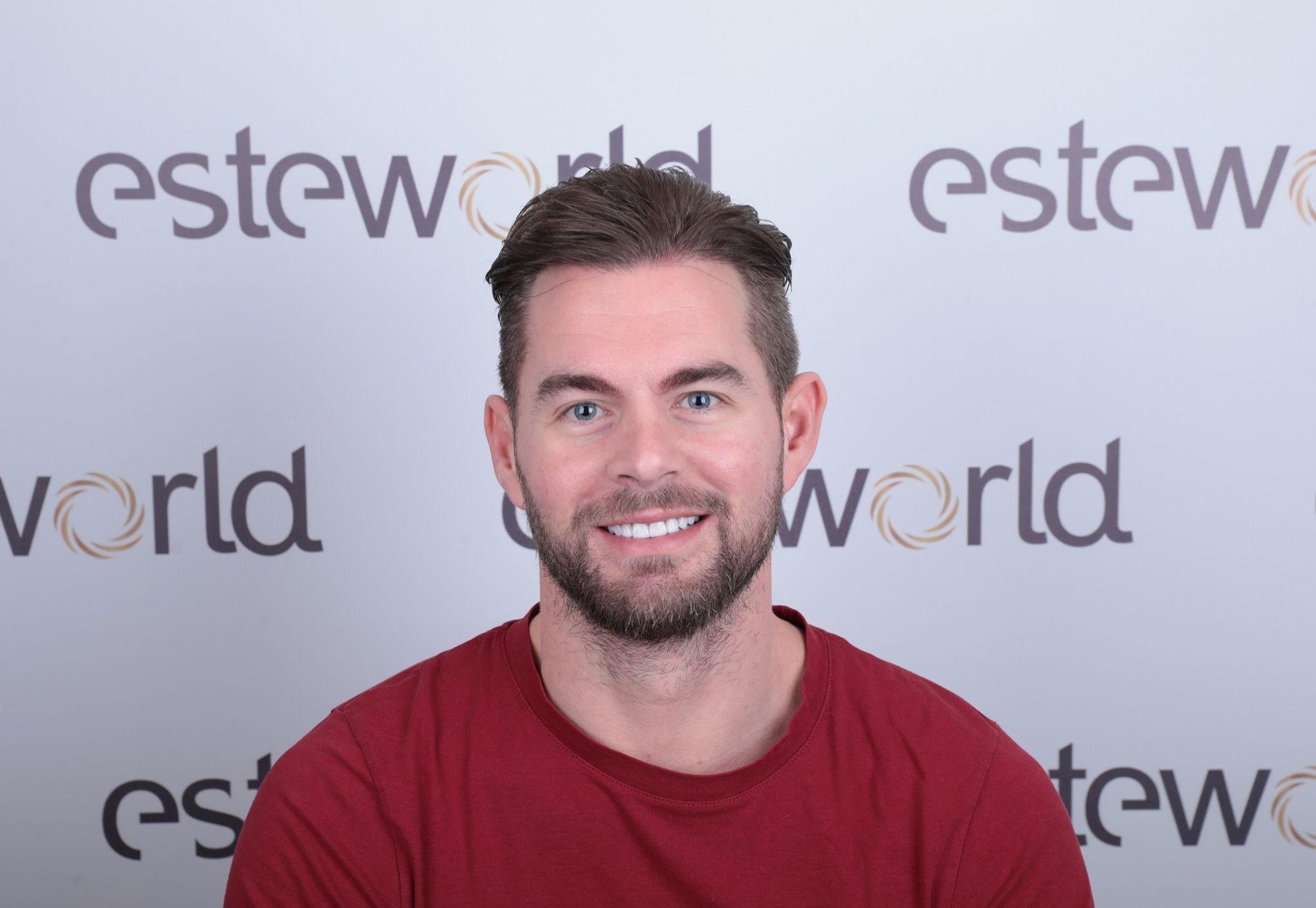 Marco,na succesvolle haartransplantatie nu naar de tandarts