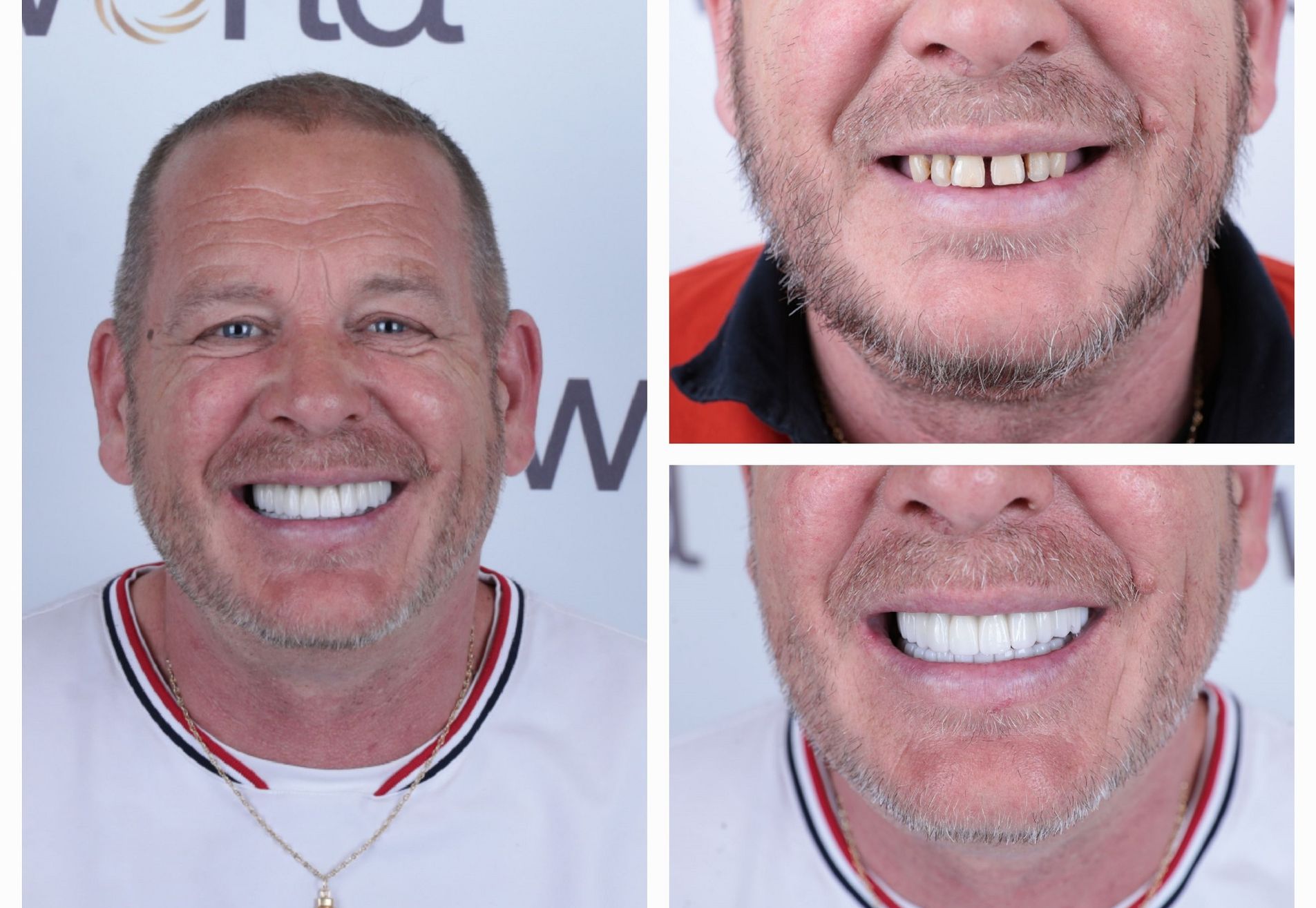 Lizant, mijn gebit voor Esteworld was een ramp