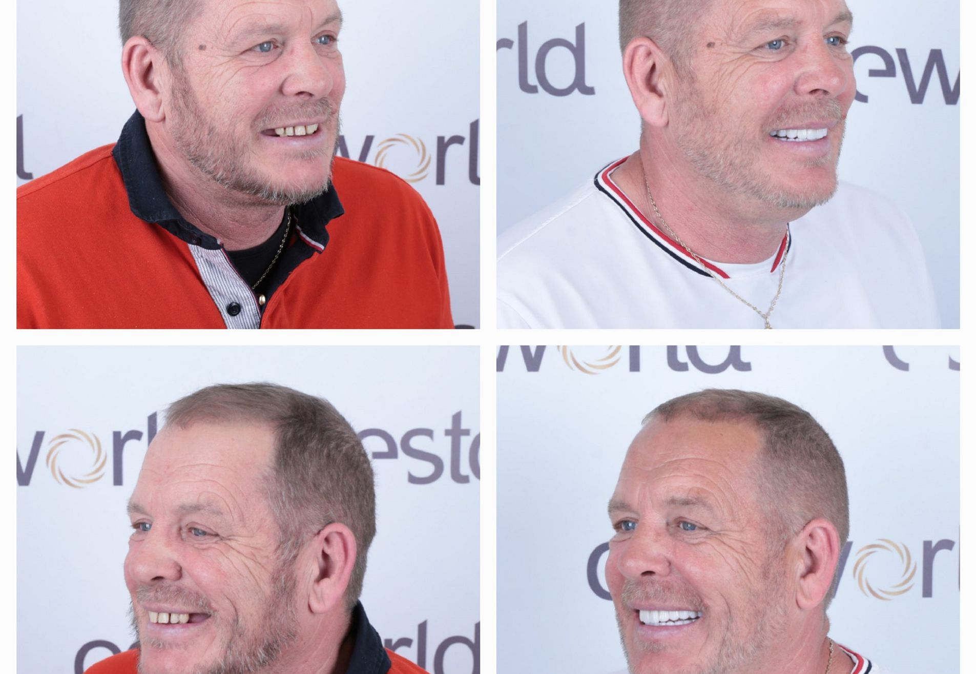 Lizant, mijn gebit voor Esteworld was een ramp