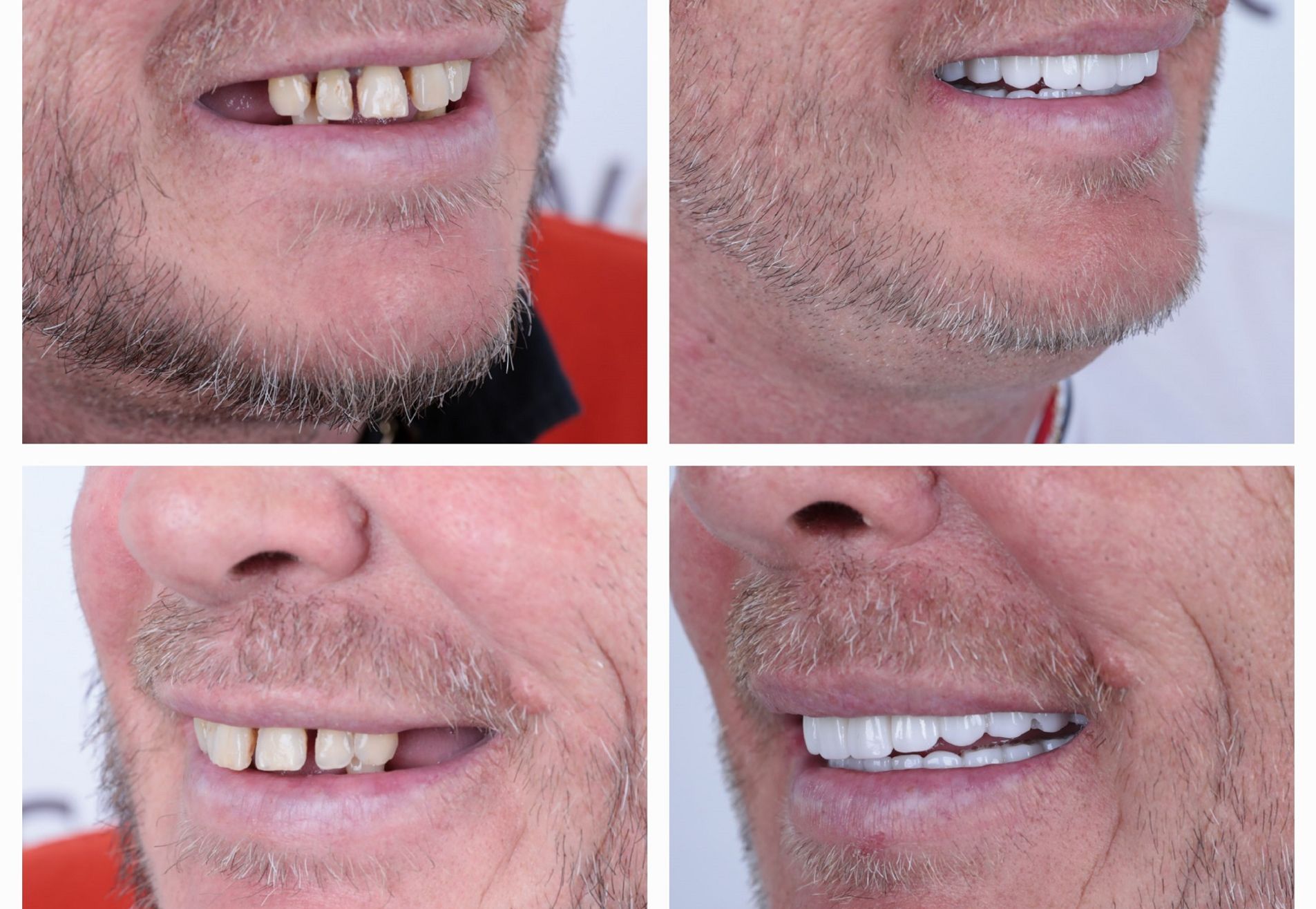 Lizant, mijn gebit voor Esteworld was een ramp