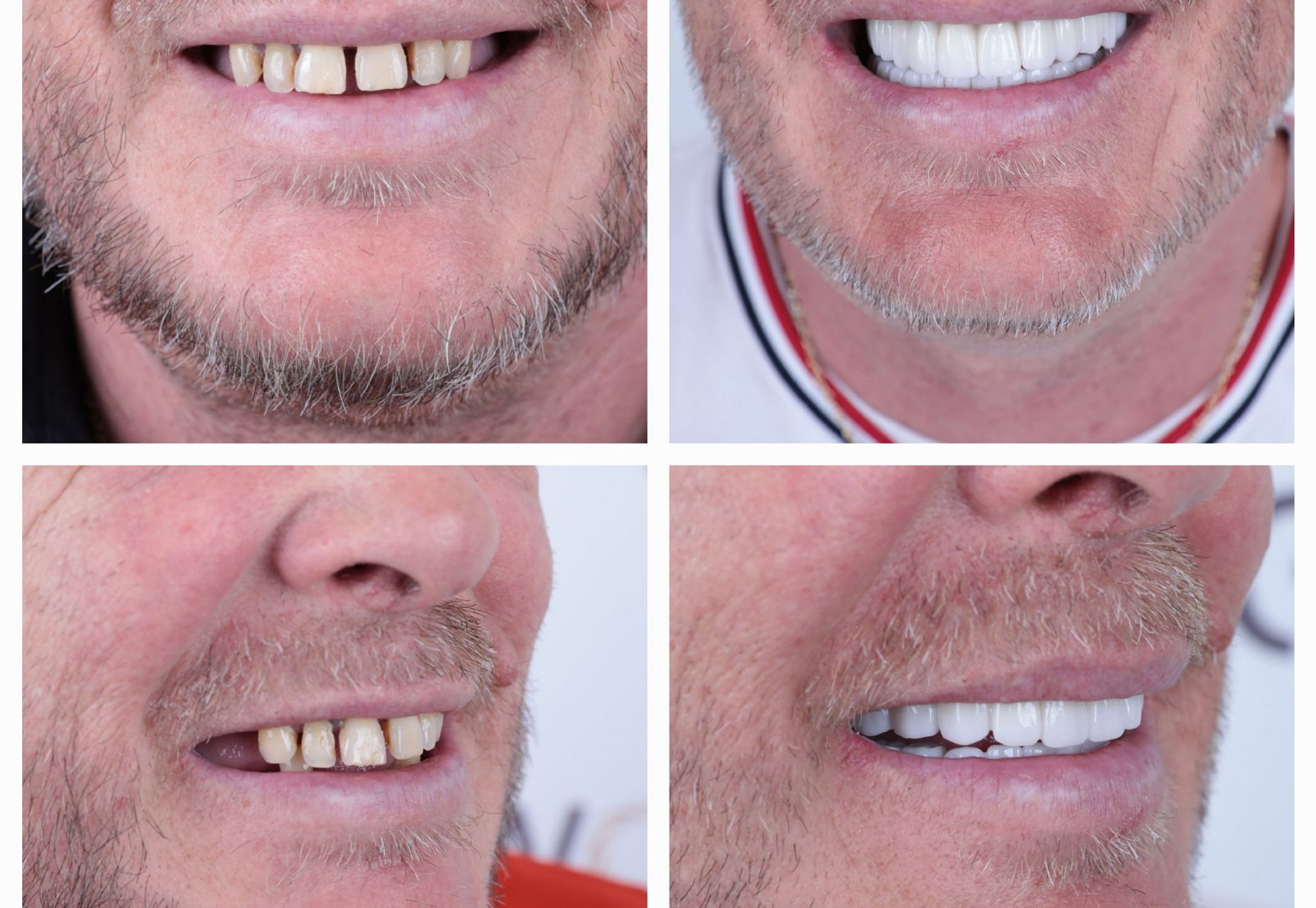 Lizant, mijn gebit voor Esteworld was een ramp