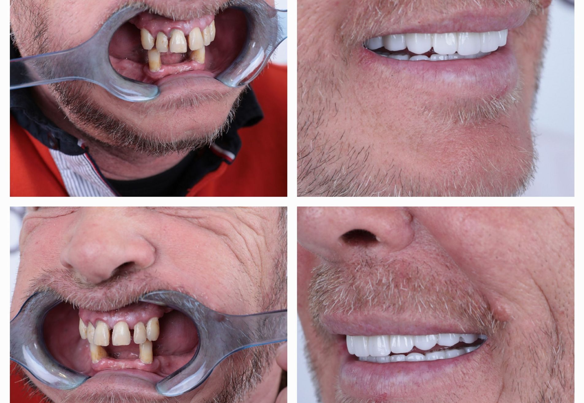 Lizant, mijn gebit voor Esteworld was een ramp