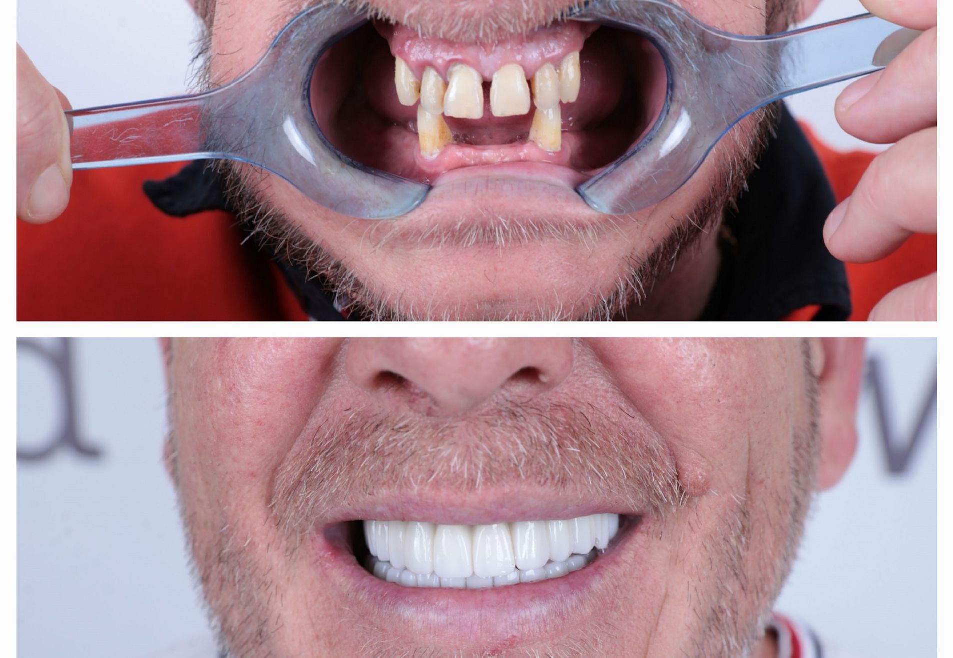 Lizant, mijn gebit voor Esteworld was een ramp