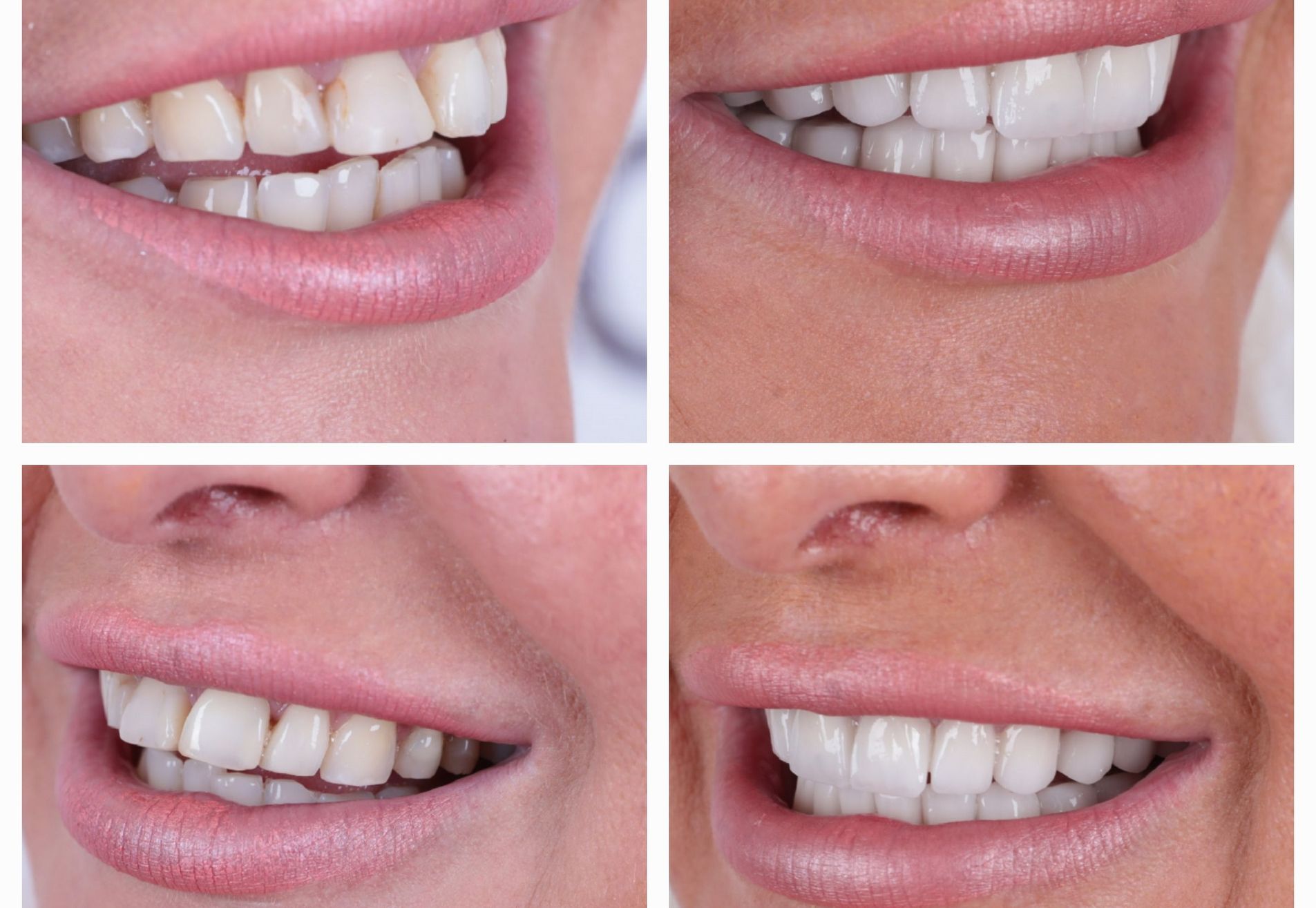 Joan wilde die mooie witte lach terug