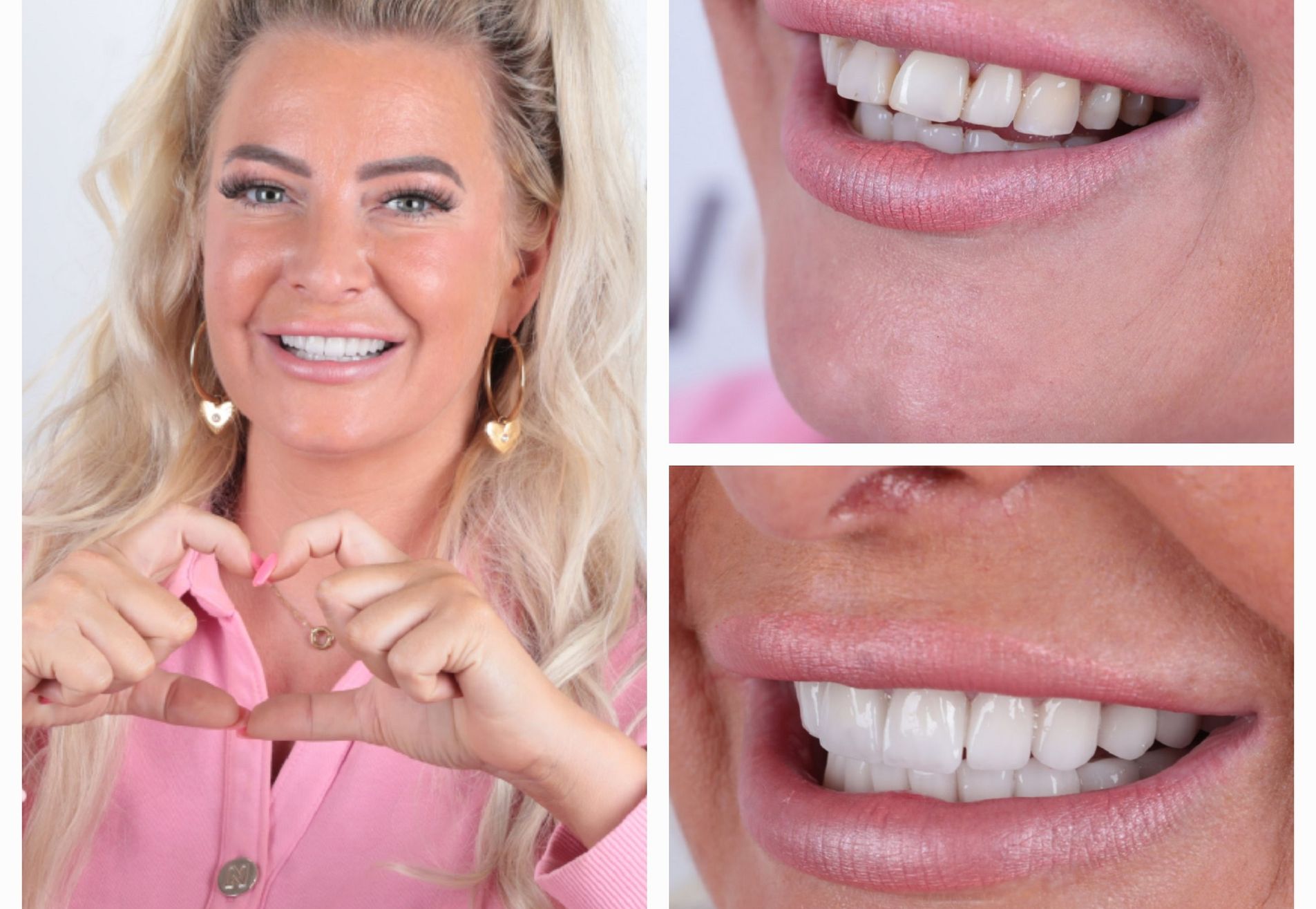 Joan wilde die mooie witte lach terug