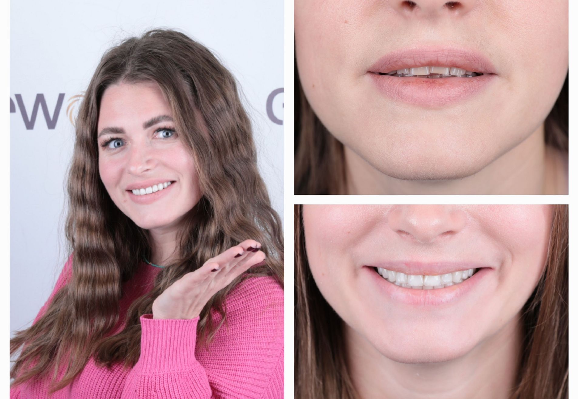 Shirley, onzeker door mijn oude lach