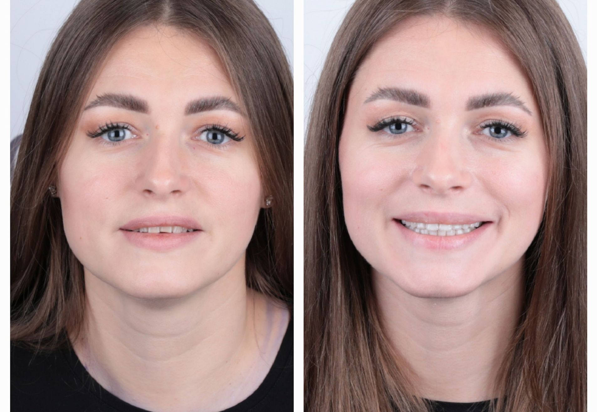 Shirley, onzeker door mijn oude lach