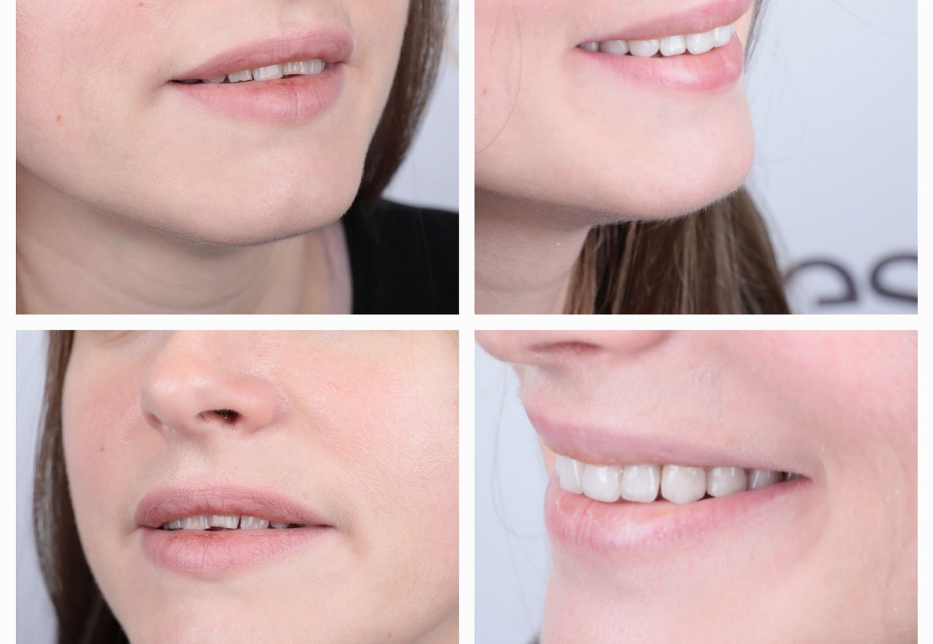 Shirley, onzeker door mijn oude lach