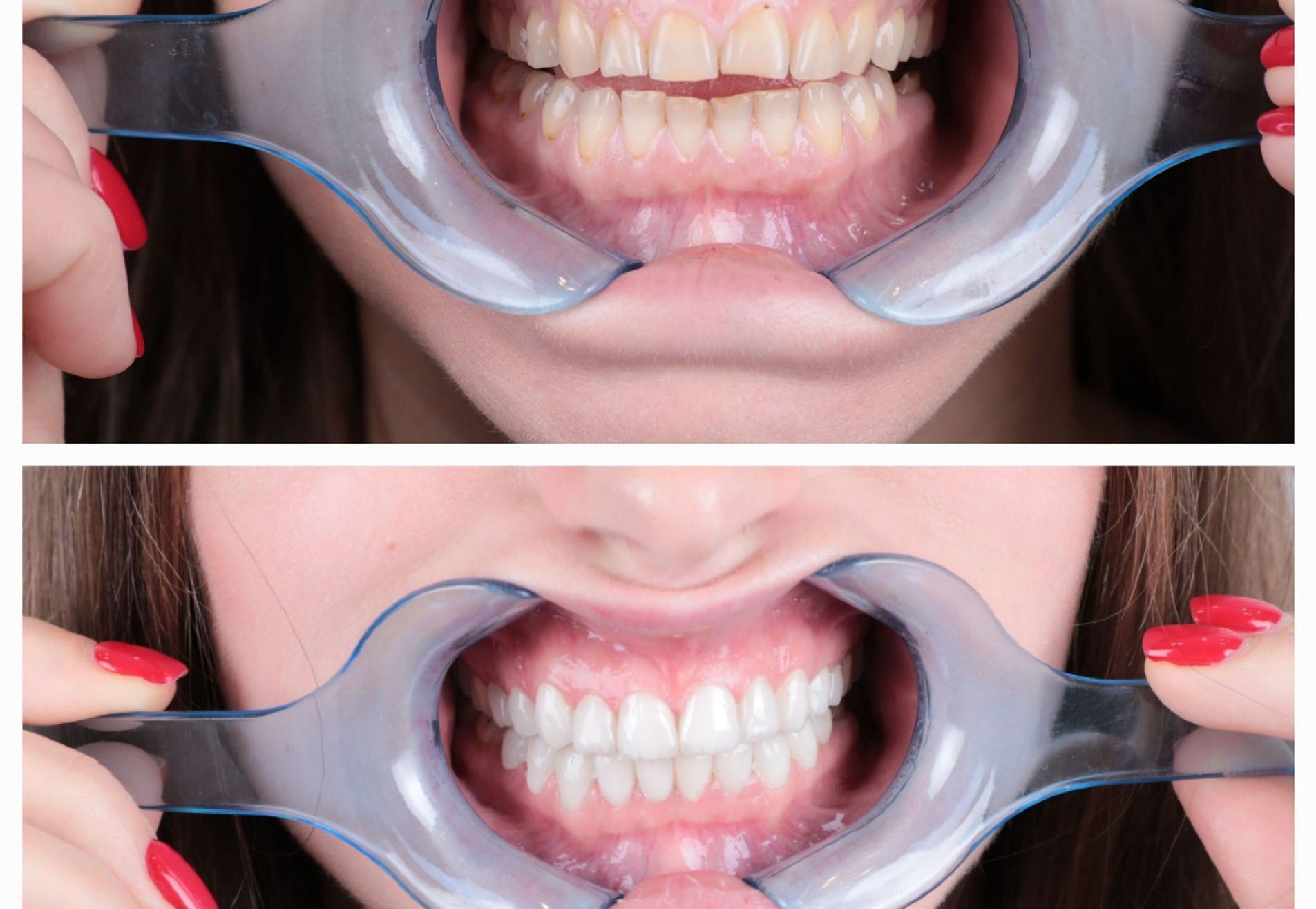 Shirley, onzeker door mijn oude lach