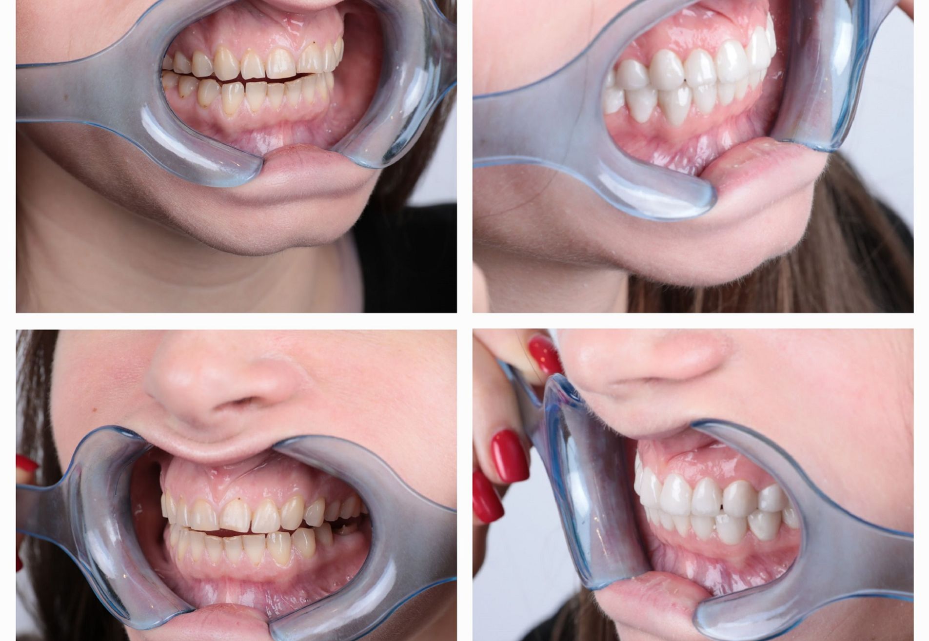 Shirley, onzeker door mijn oude lach