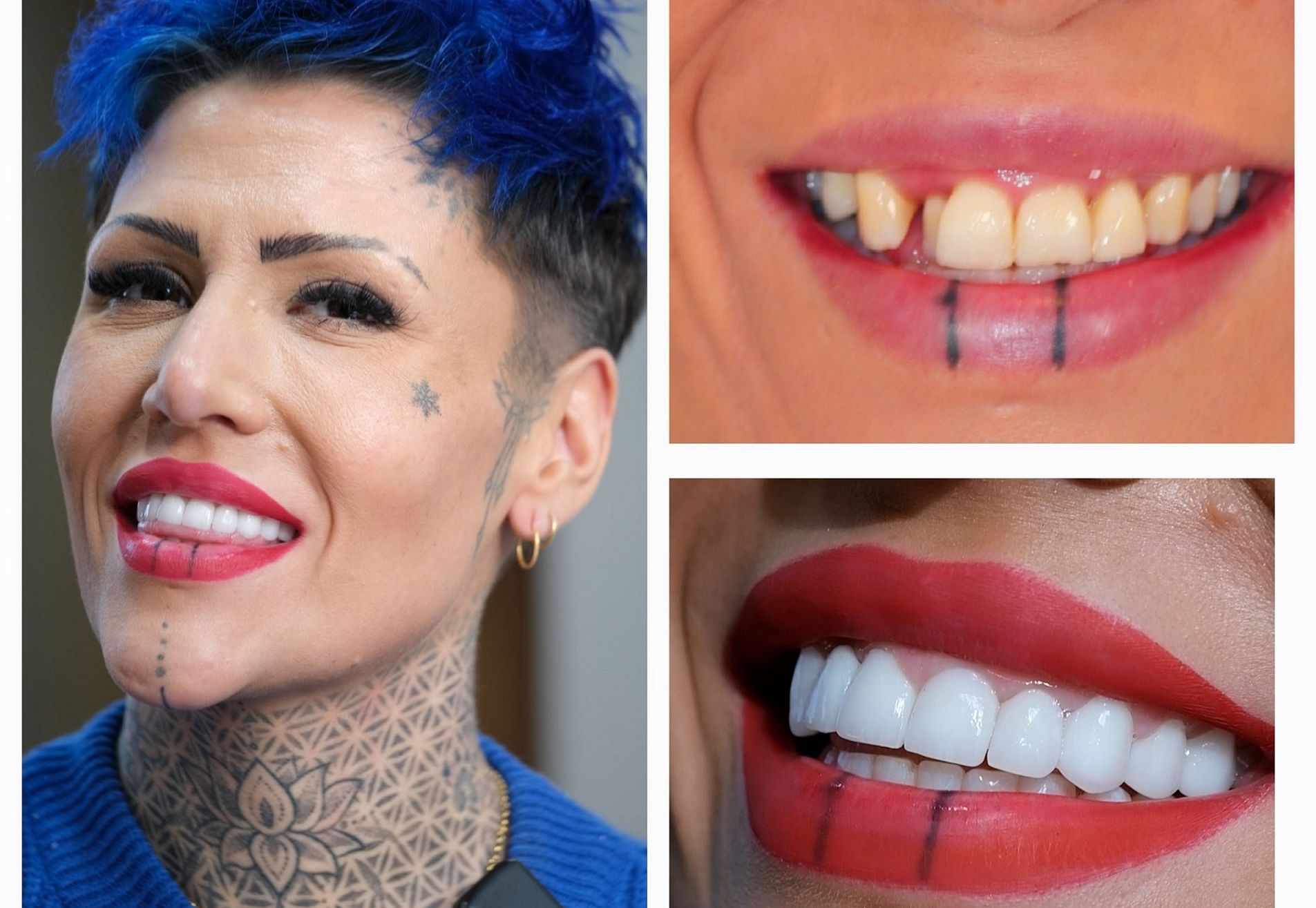 Jennifer, tijd voor een gebit dat bij me past