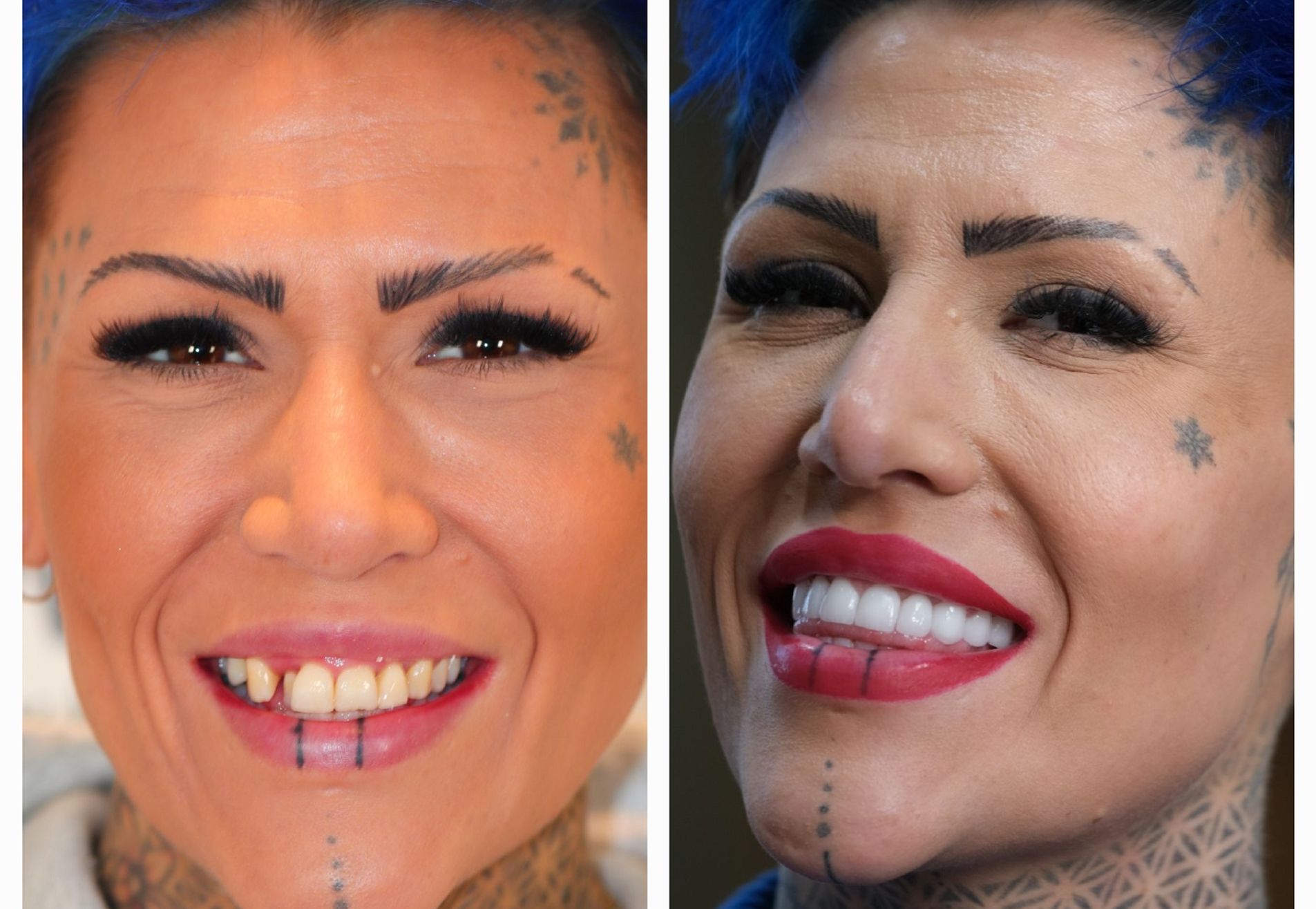 Jennifer, tijd voor een gebit dat bij me past