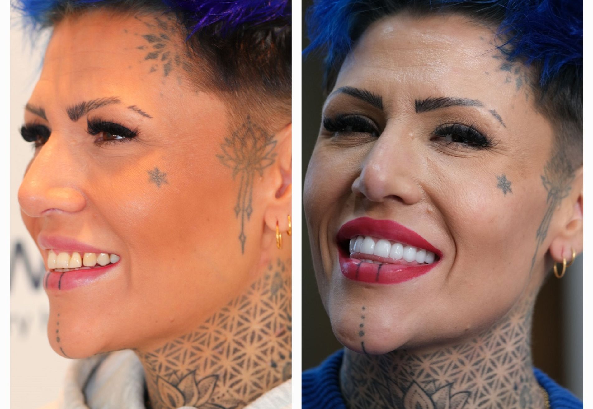 Jennifer, tijd voor een gebit dat bij me past