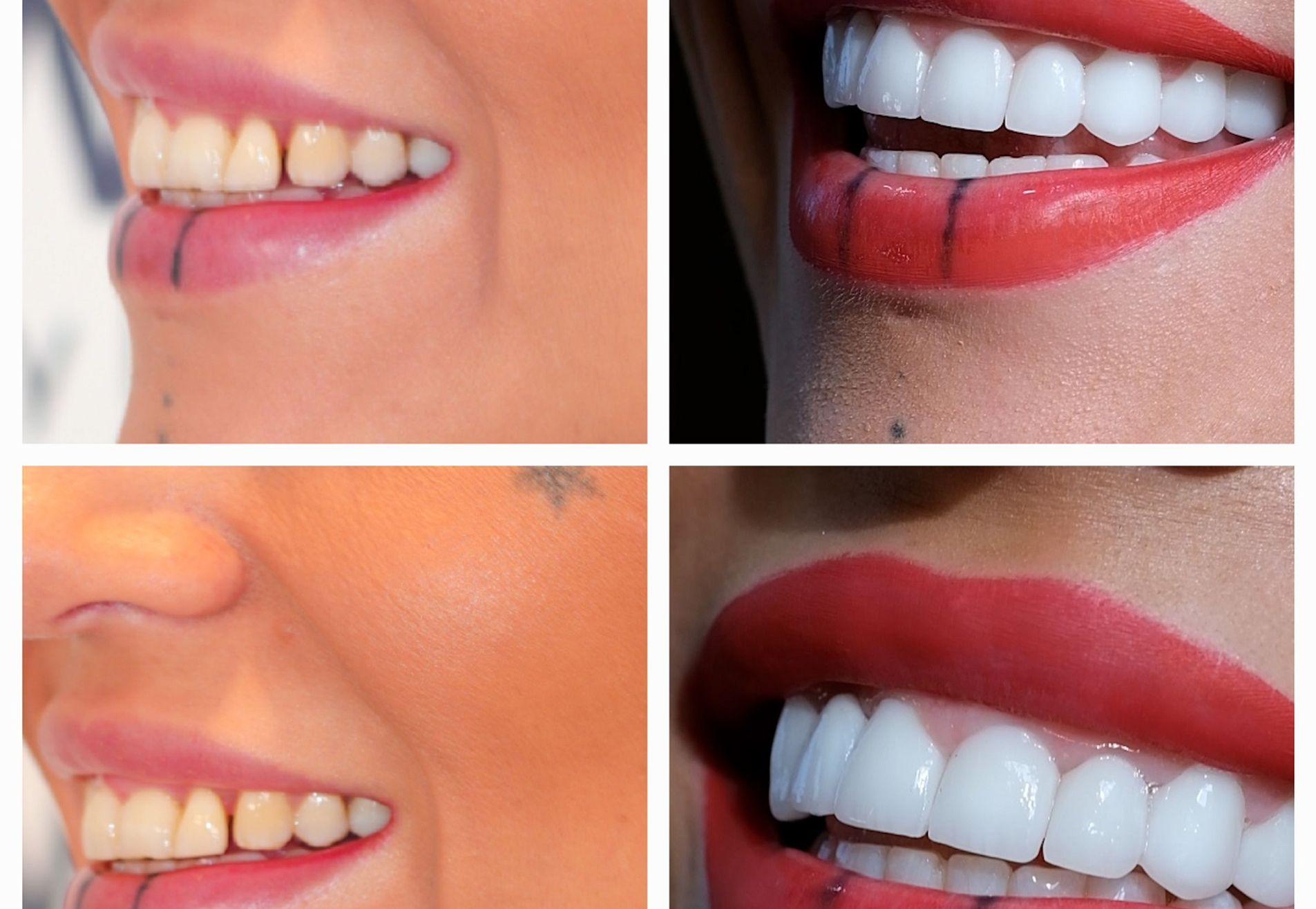 Jennifer, tijd voor een gebit dat bij me past