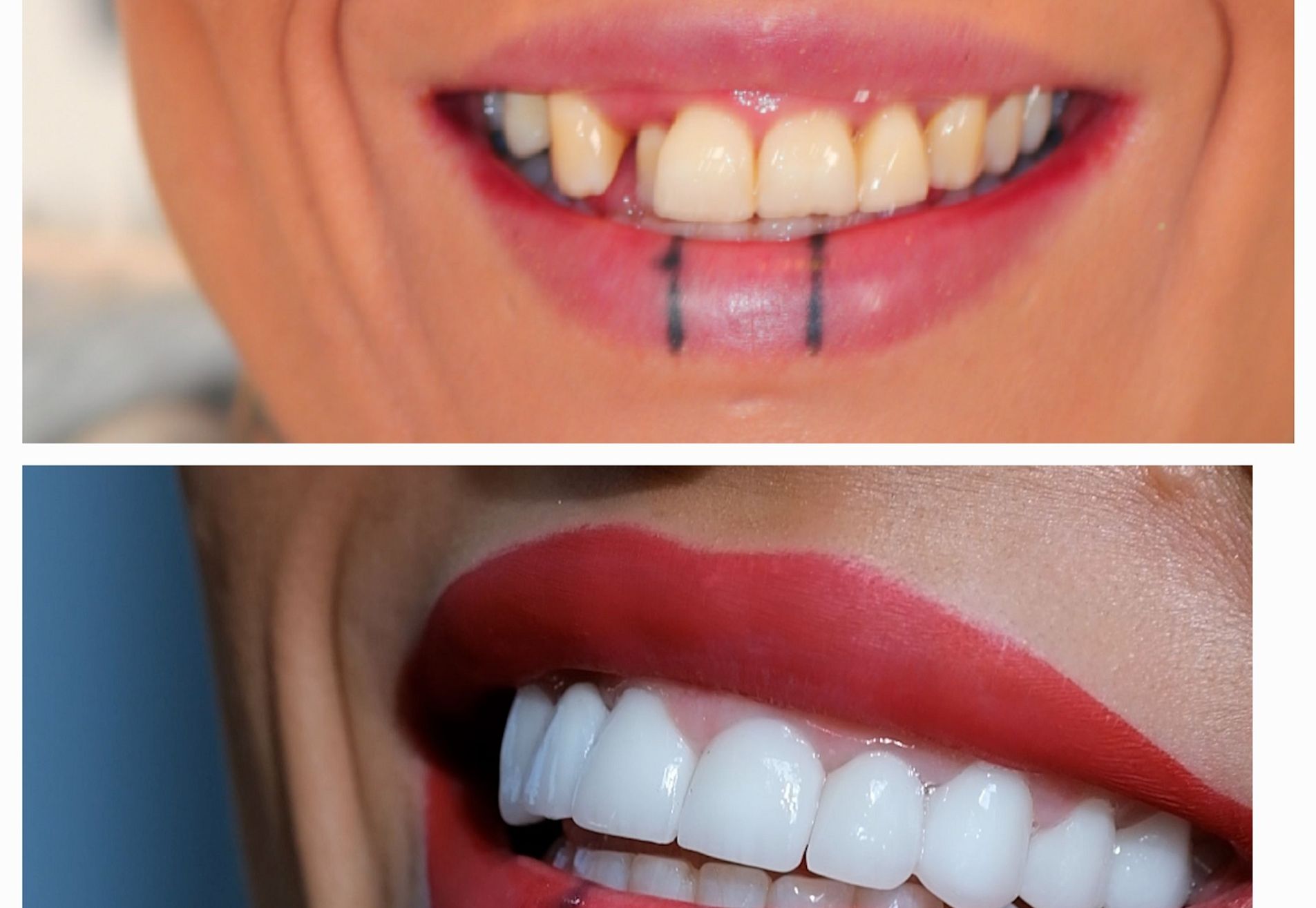 Jennifer, tijd voor een gebit dat bij me past