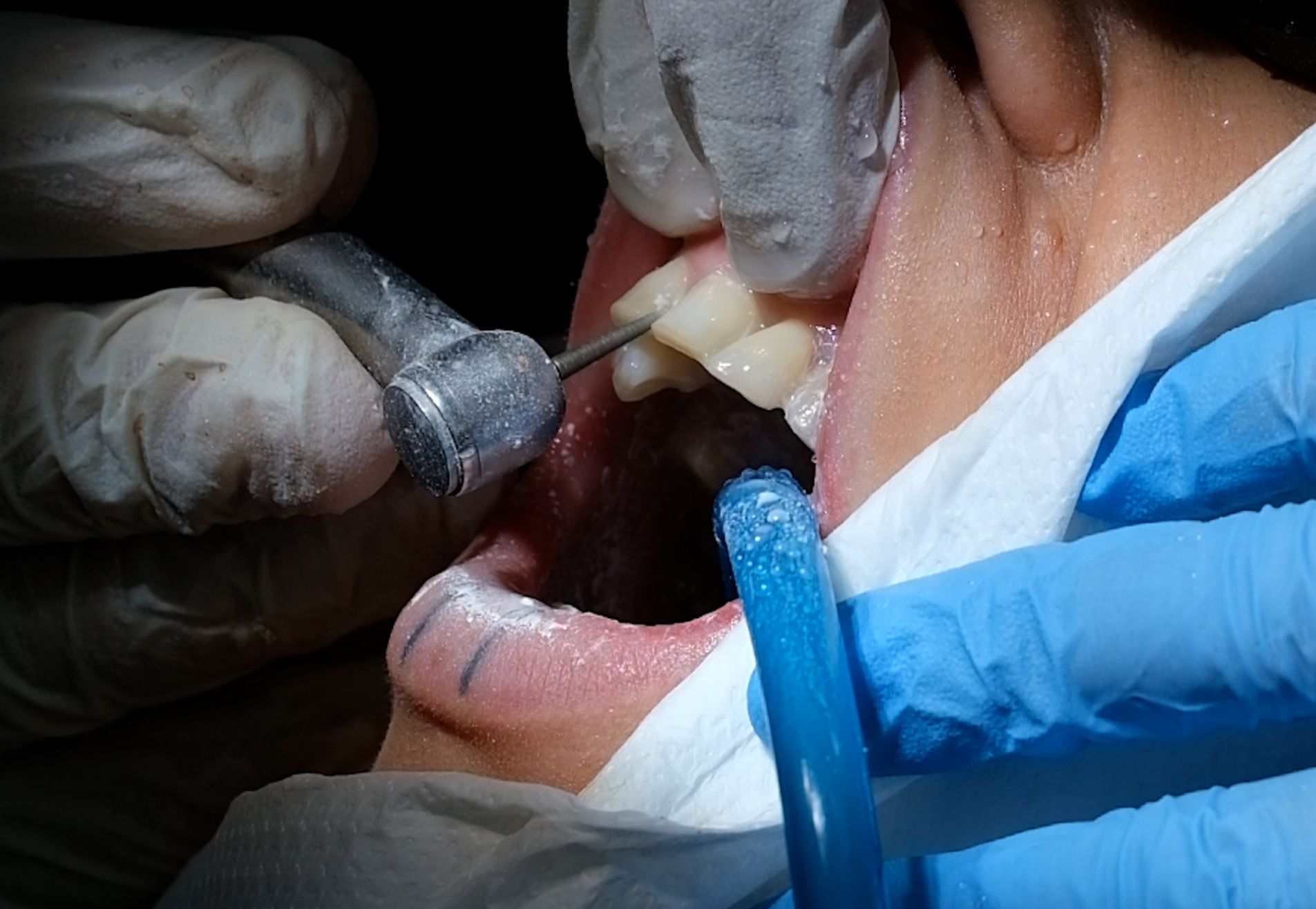 Jennifer, tijd voor een gebit dat bij me past