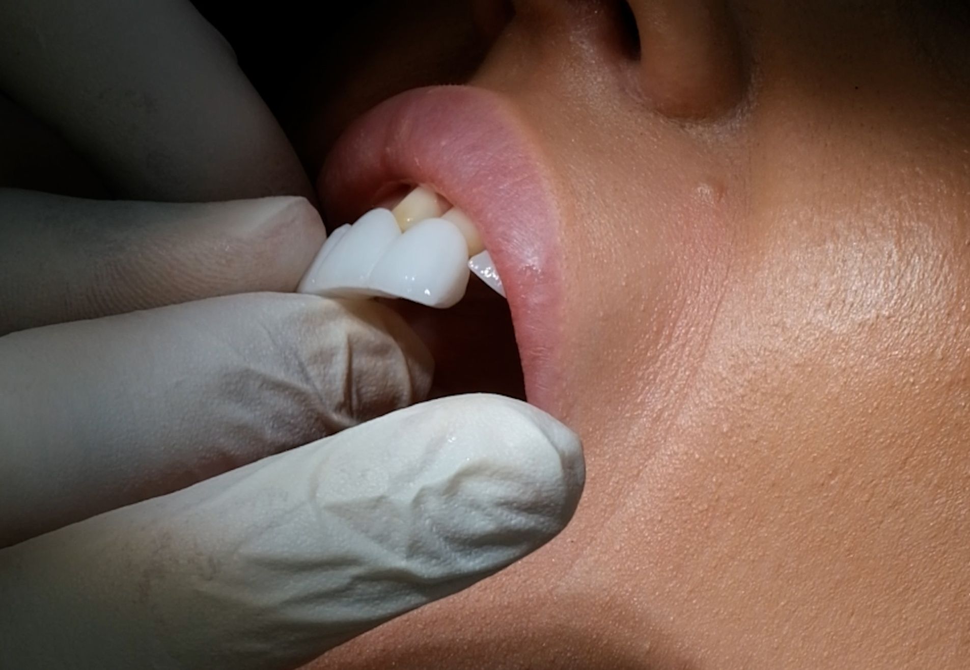 Jennifer, tijd voor een gebit dat bij me past