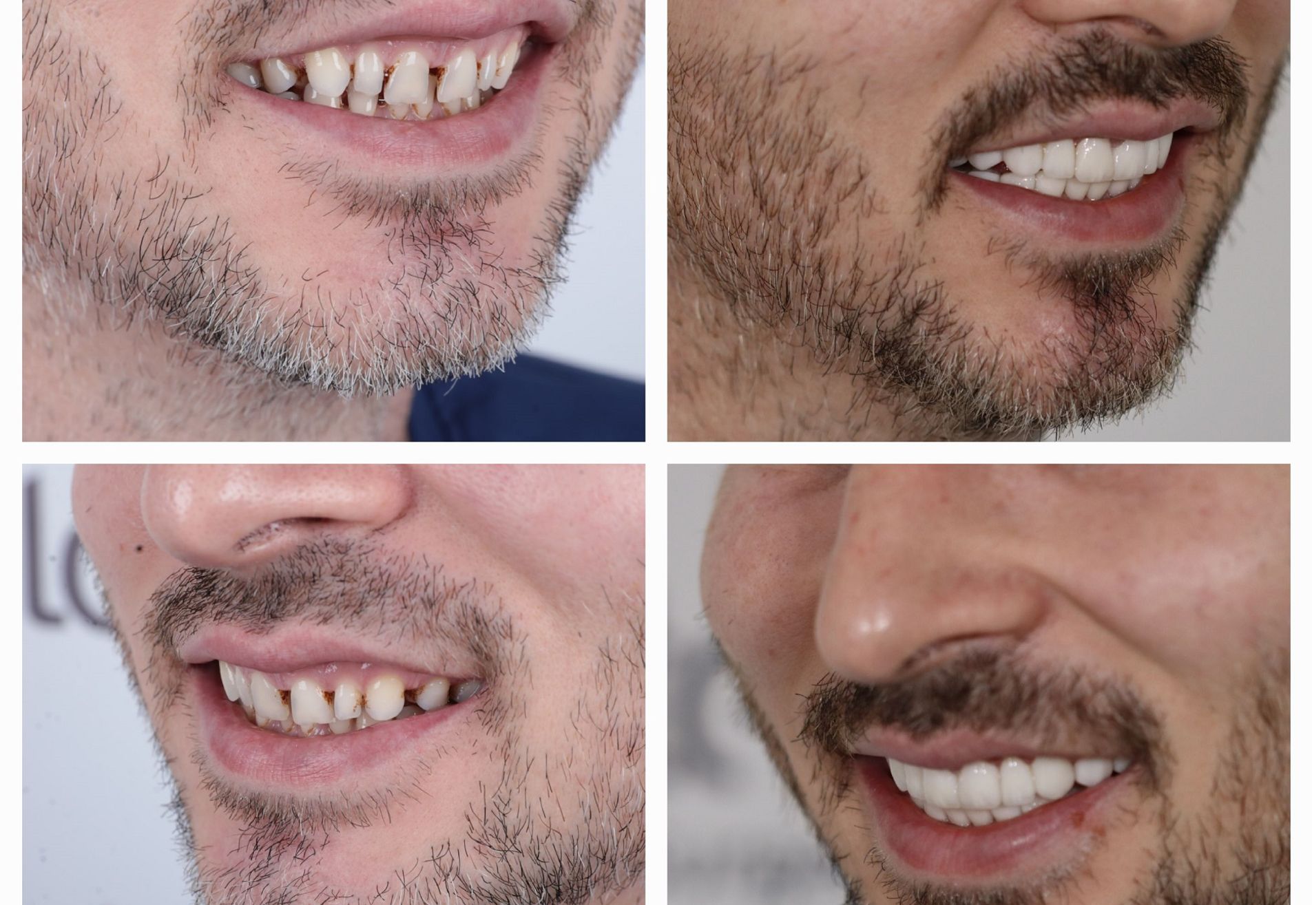 Omar door zijn vrouw naar Esteworld gestuurd