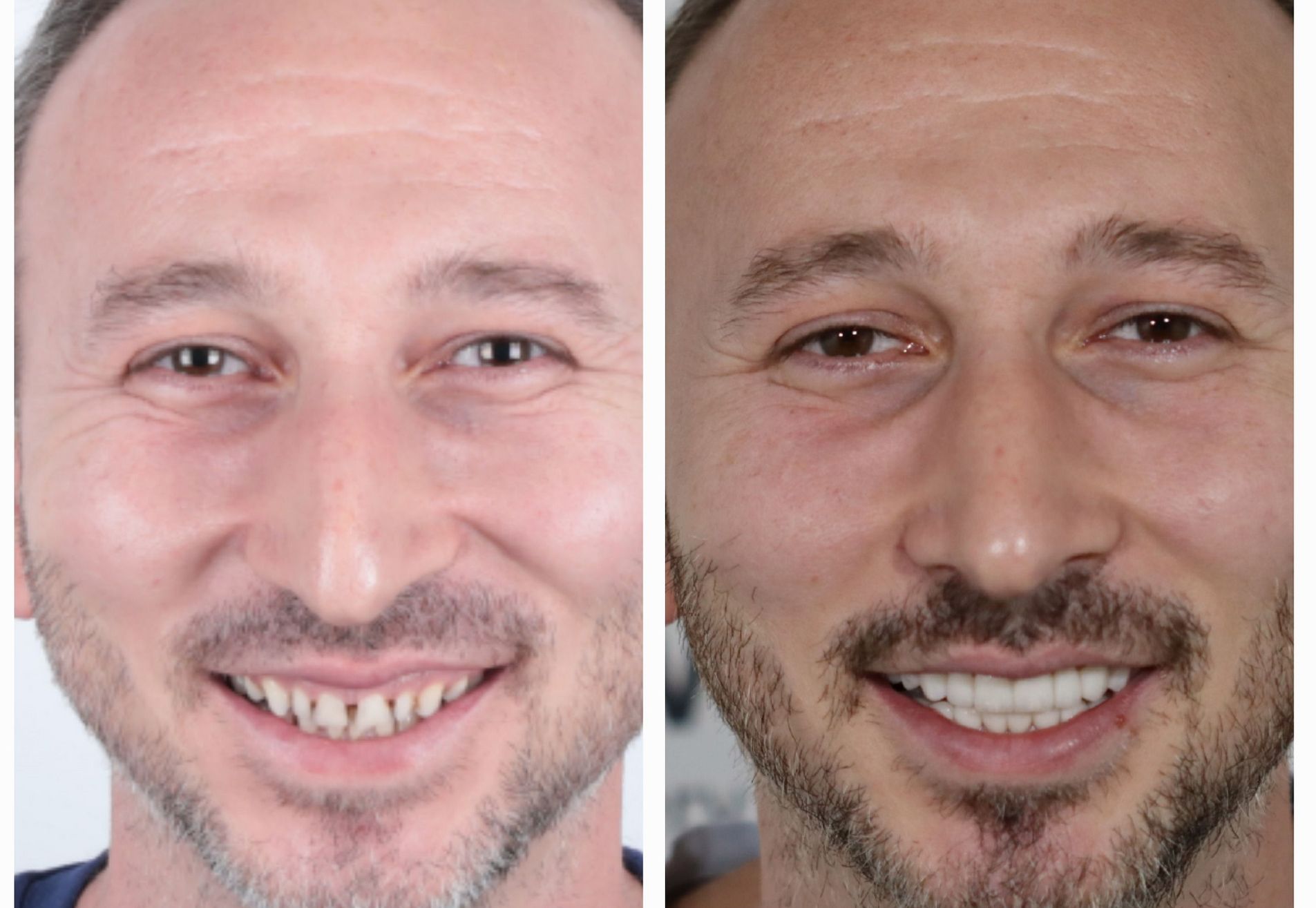 Omar door zijn vrouw naar Esteworld gestuurd