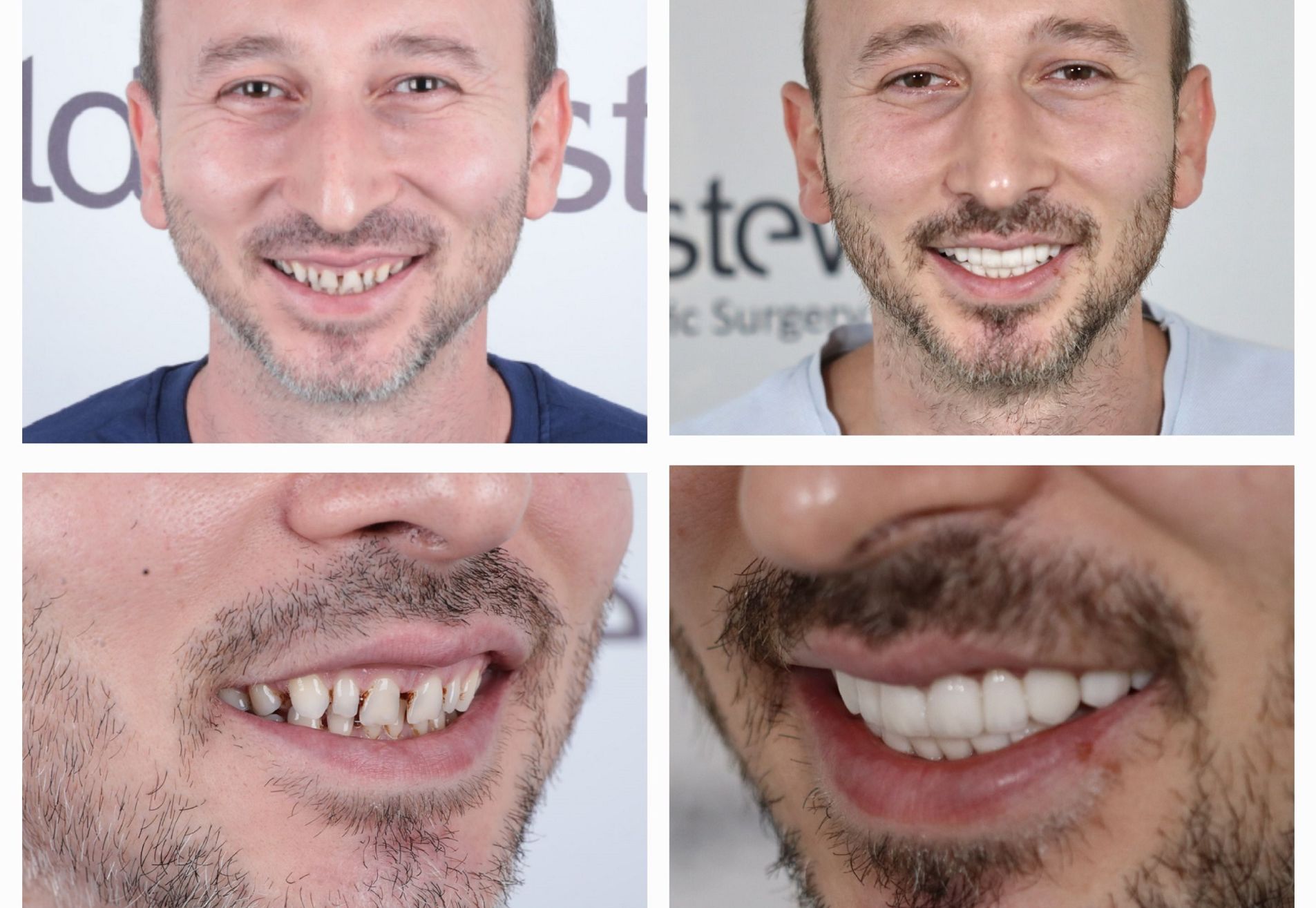 Omar door zijn vrouw naar Esteworld gestuurd