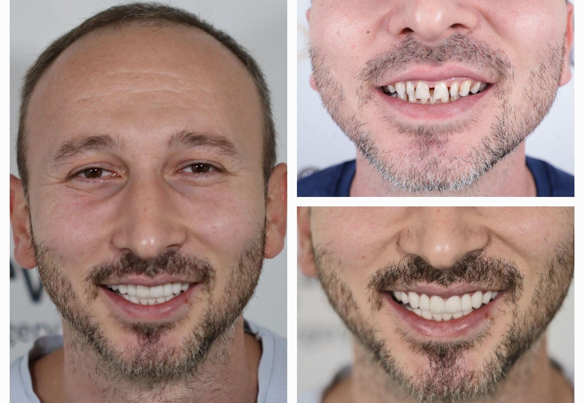 Omar door zijn vrouw naar Esteworld gestuurd