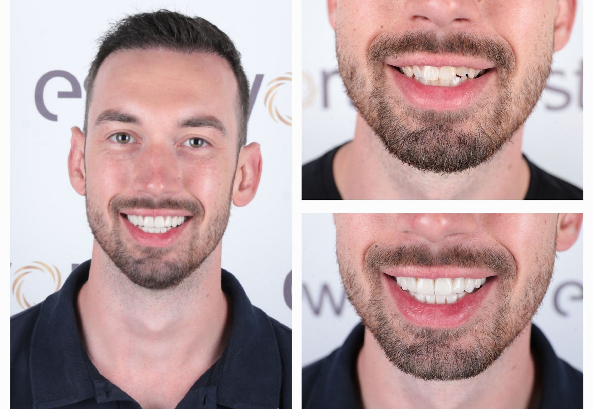 Marco Beuk terug naar Esteworld voor kronen