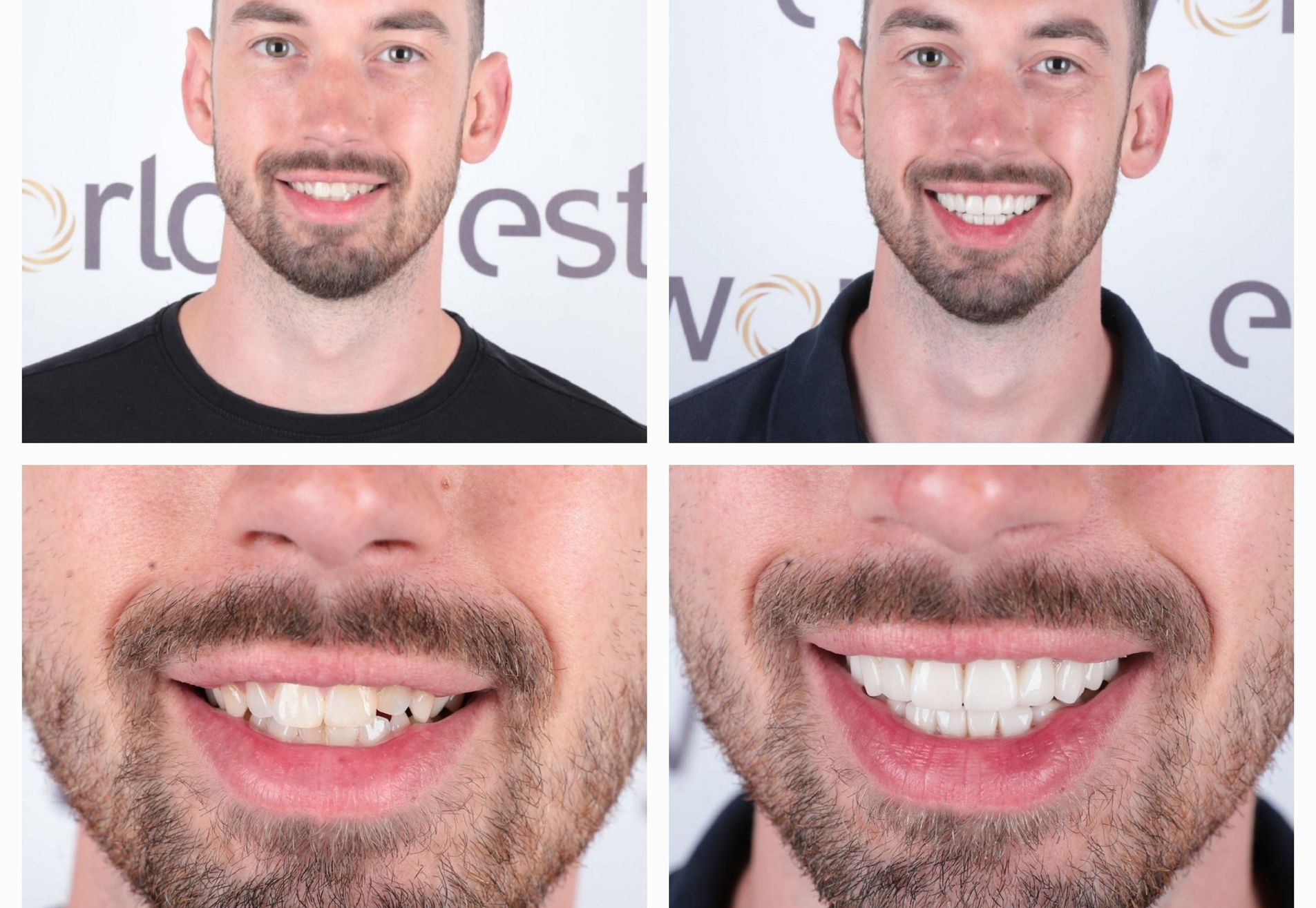 Marco Beuk terug naar Esteworld voor kronen