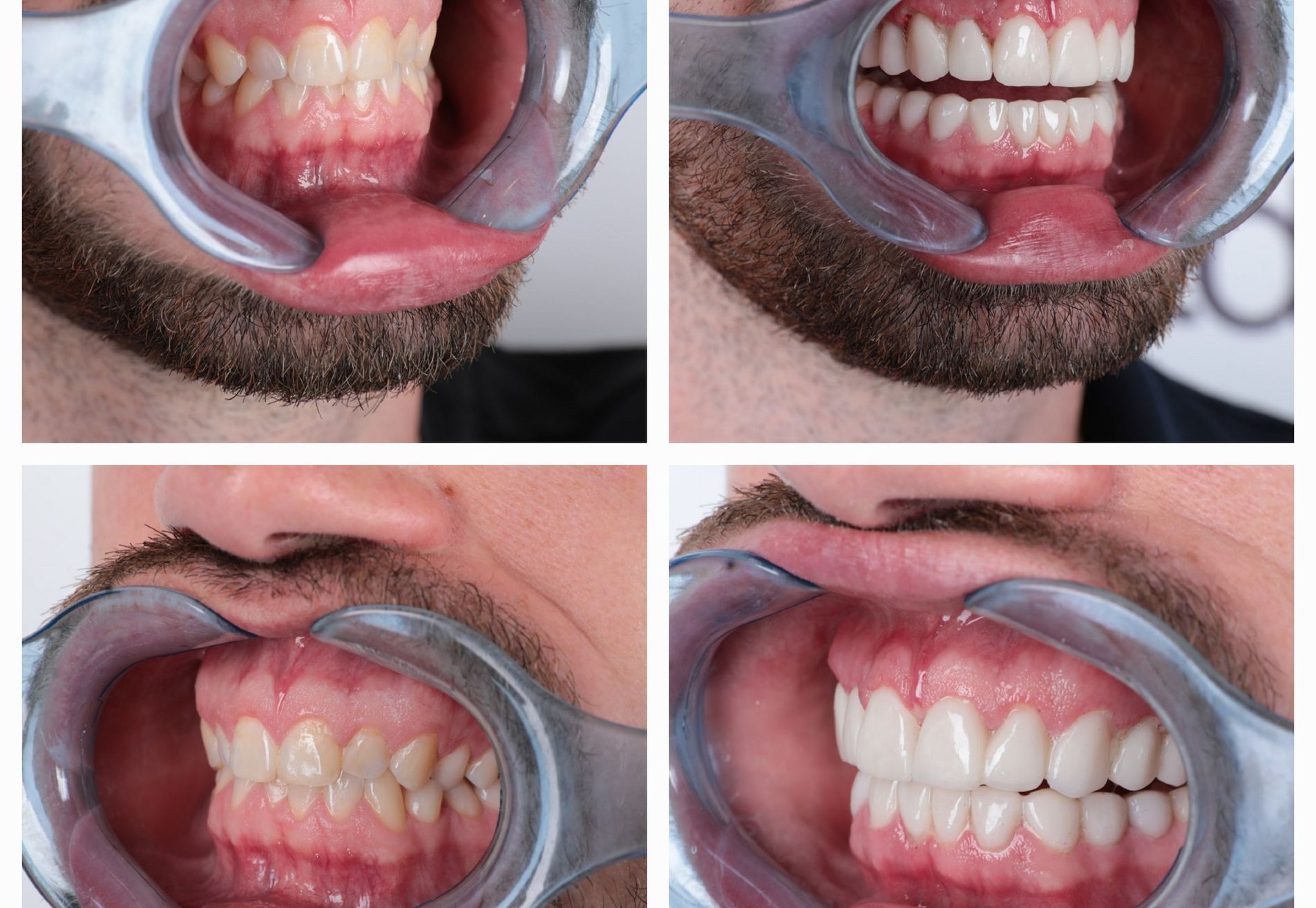 Marco Beuk terug naar Esteworld voor kronen