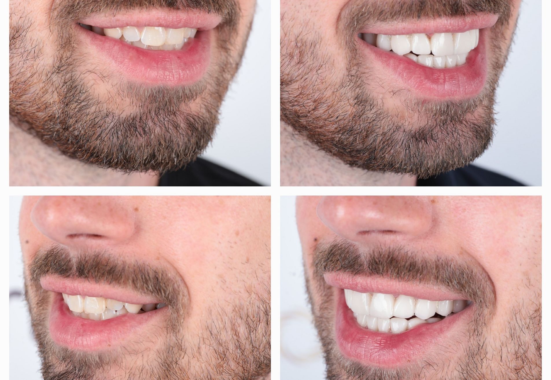 Marco Beuk terug naar Esteworld voor kronen