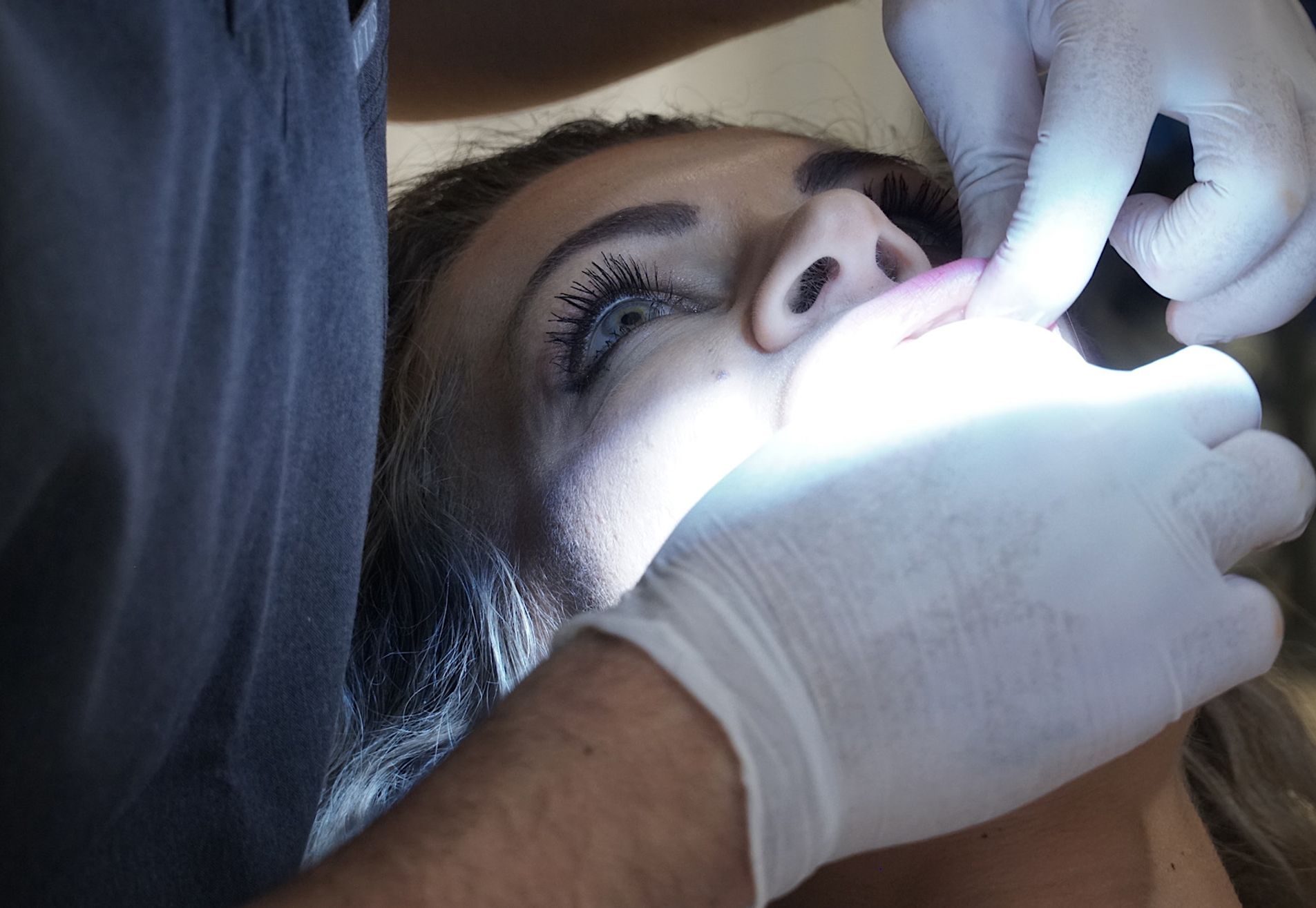 @eveliennellen door eetstoornis slecht gebit