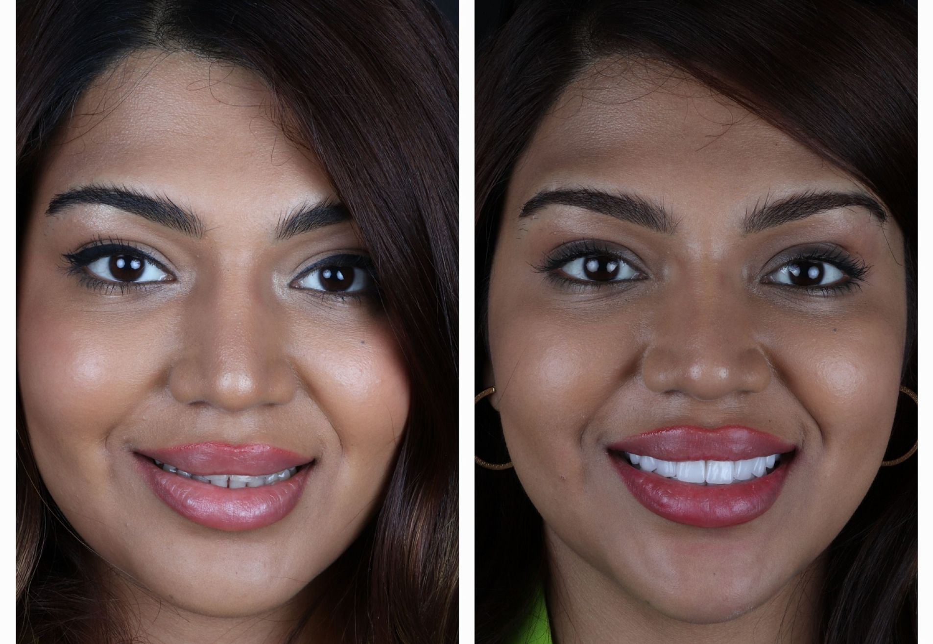 Dubai Vlogger voor kronen en Facings naar Esteworld