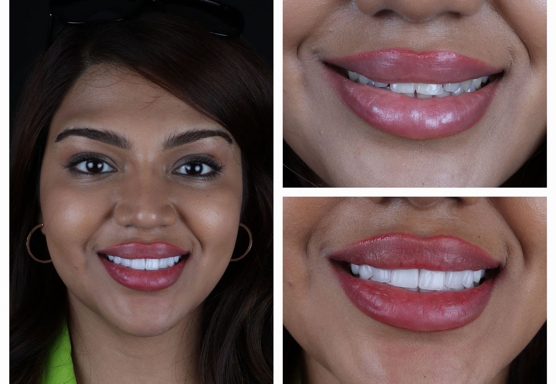 Dubai Vlogger voor kronen en Facings naar Esteworld