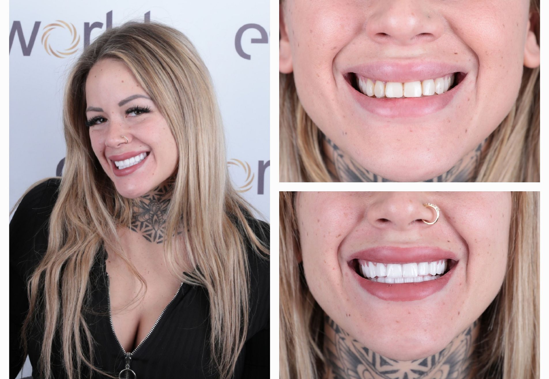 Lucretia, mijn gebit was mooi maar ik wilde meer