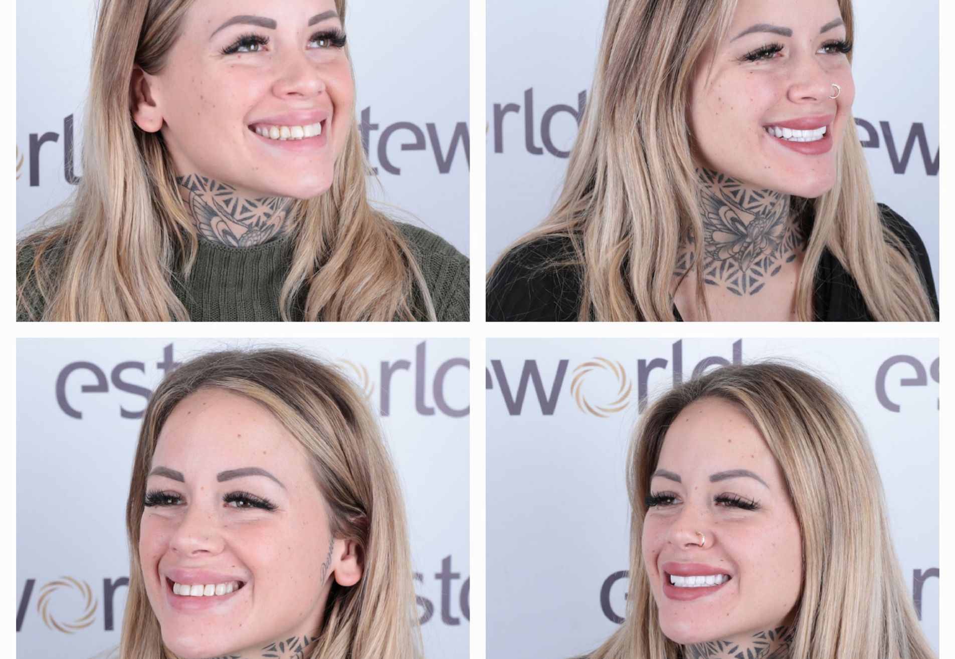 Lucretia, mijn gebit was mooi maar ik wilde meer