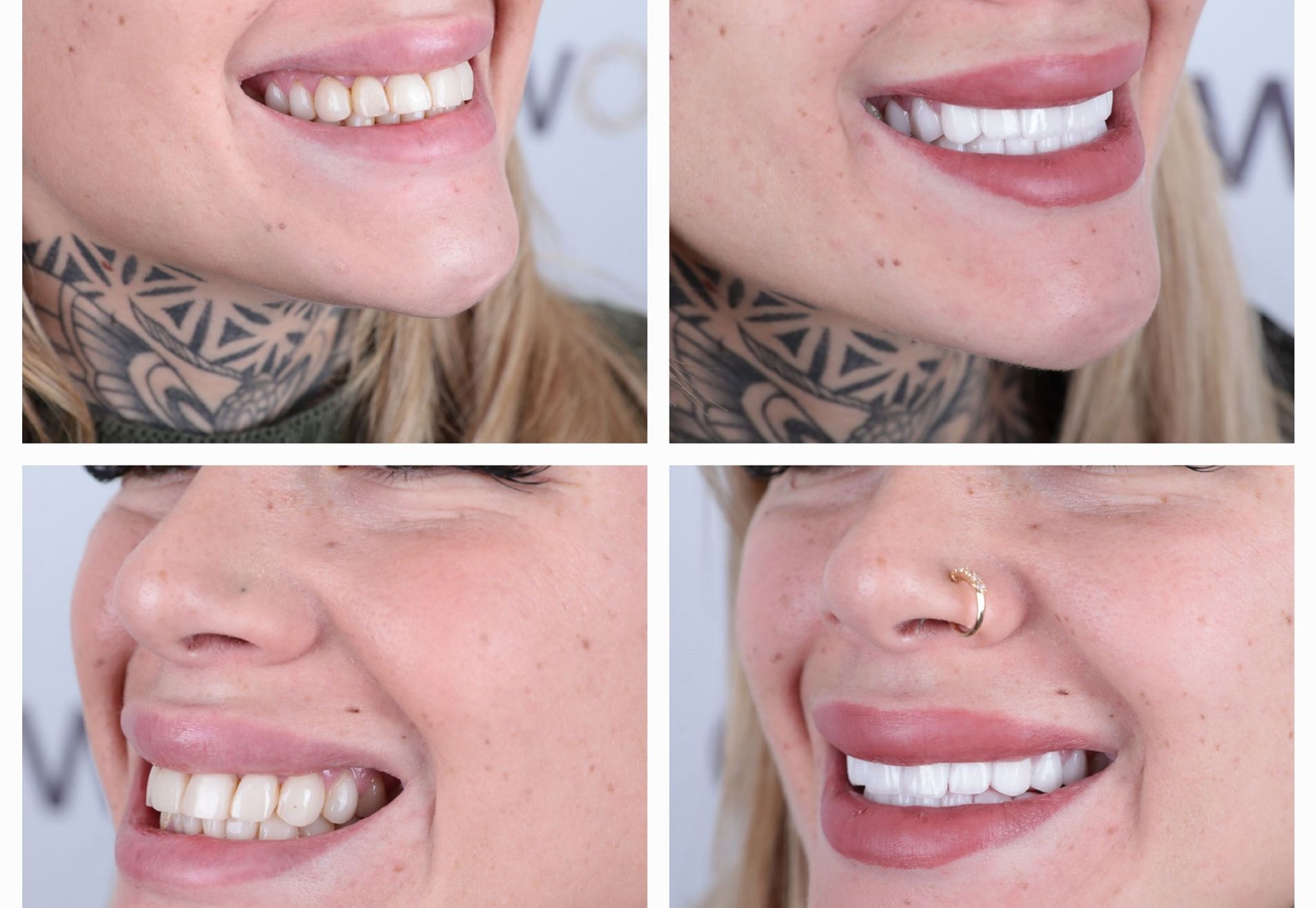 Lucretia, mijn gebit was mooi maar ik wilde meer