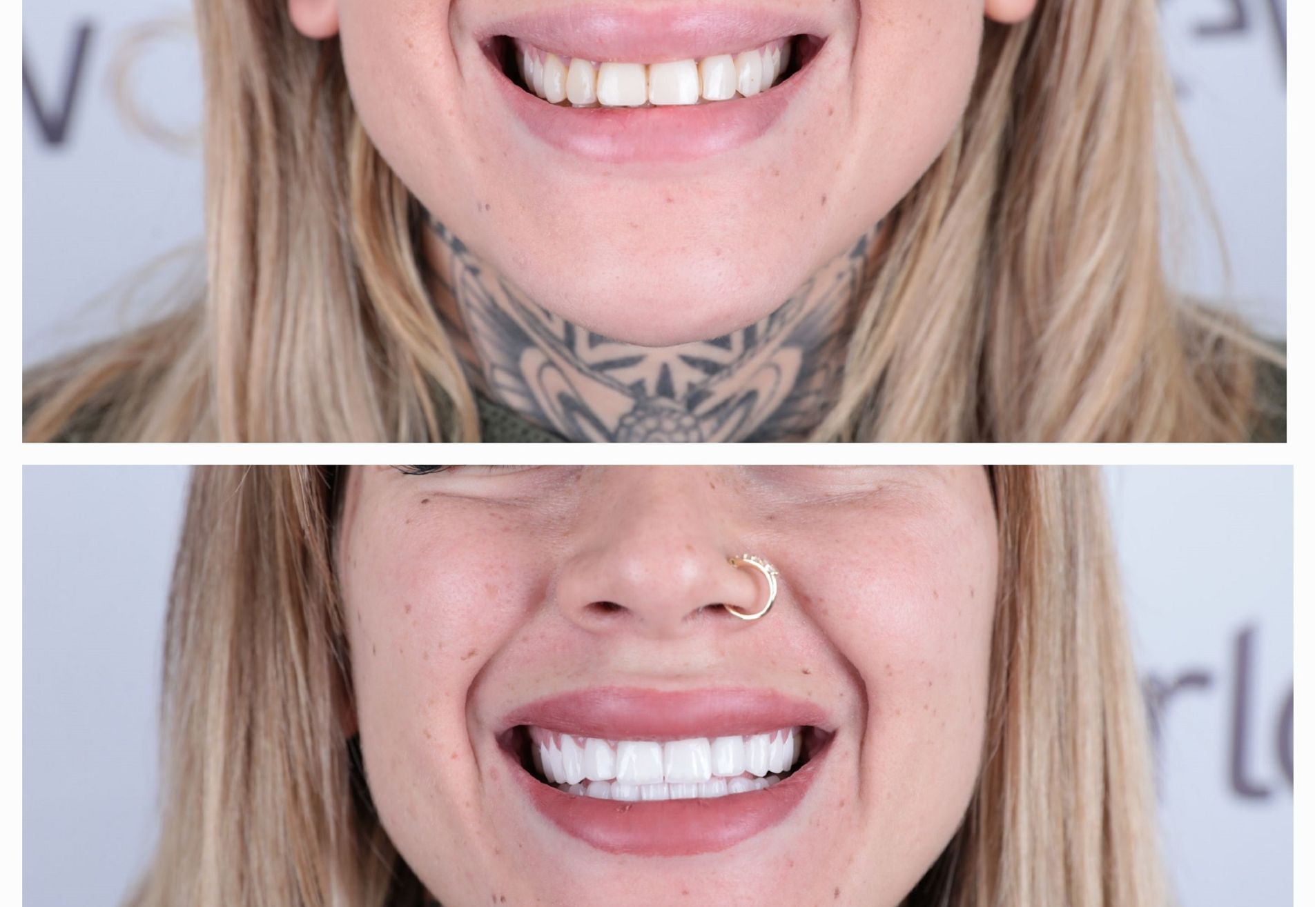 Lucretia, mijn gebit was mooi maar ik wilde meer