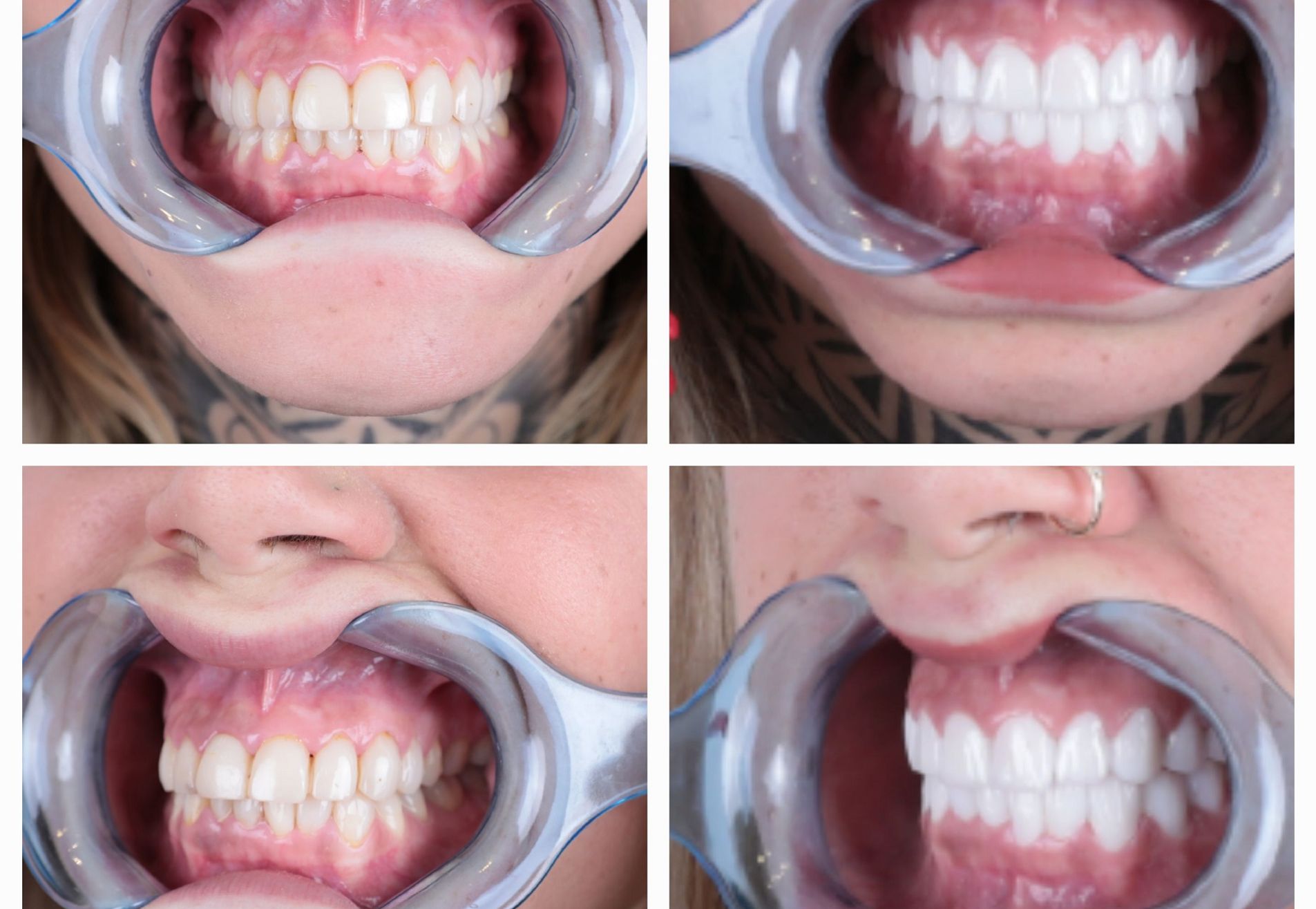 Lucretia, mijn gebit was mooi maar ik wilde meer