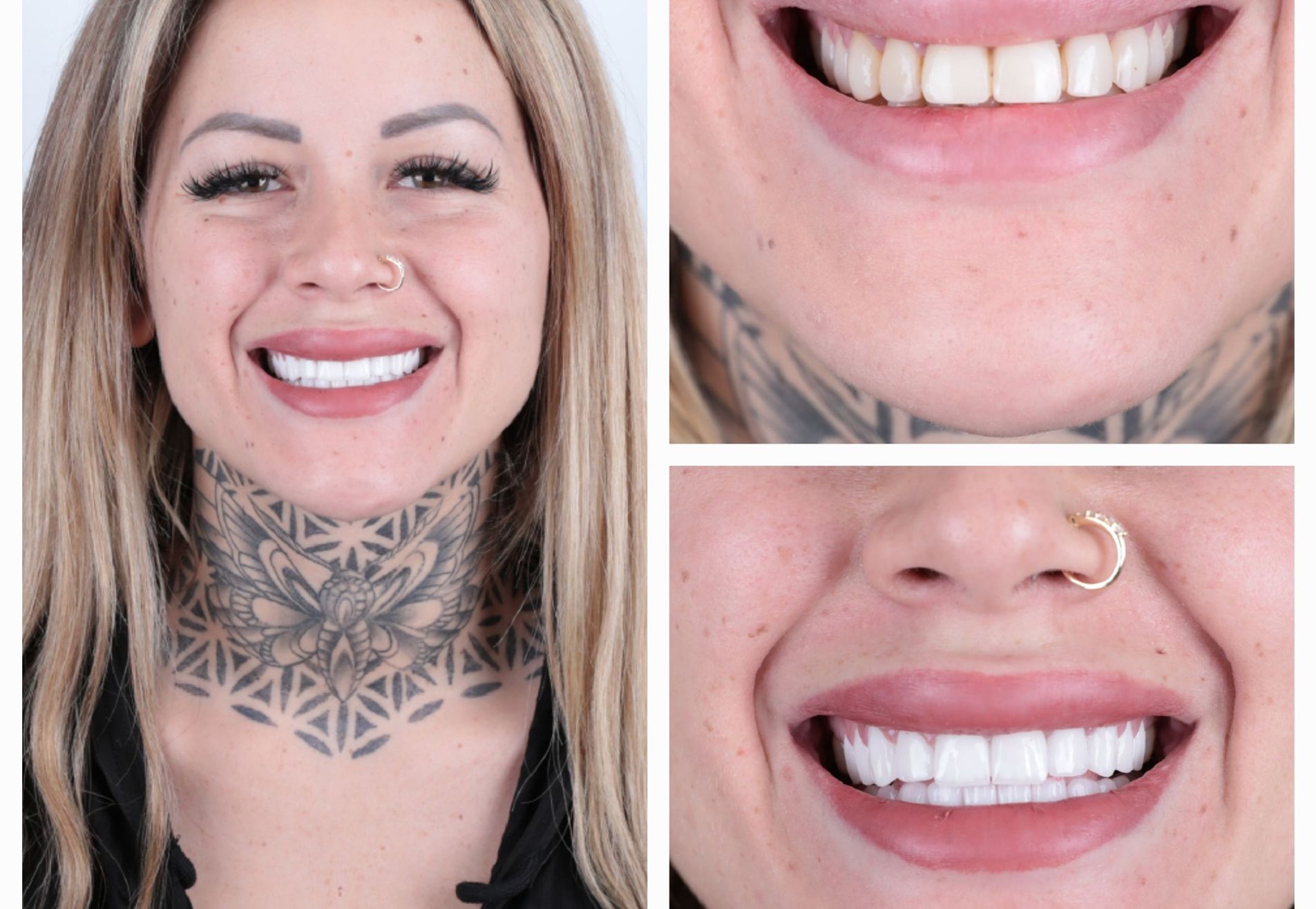 Lucretia, mijn gebit was mooi maar ik wilde meer