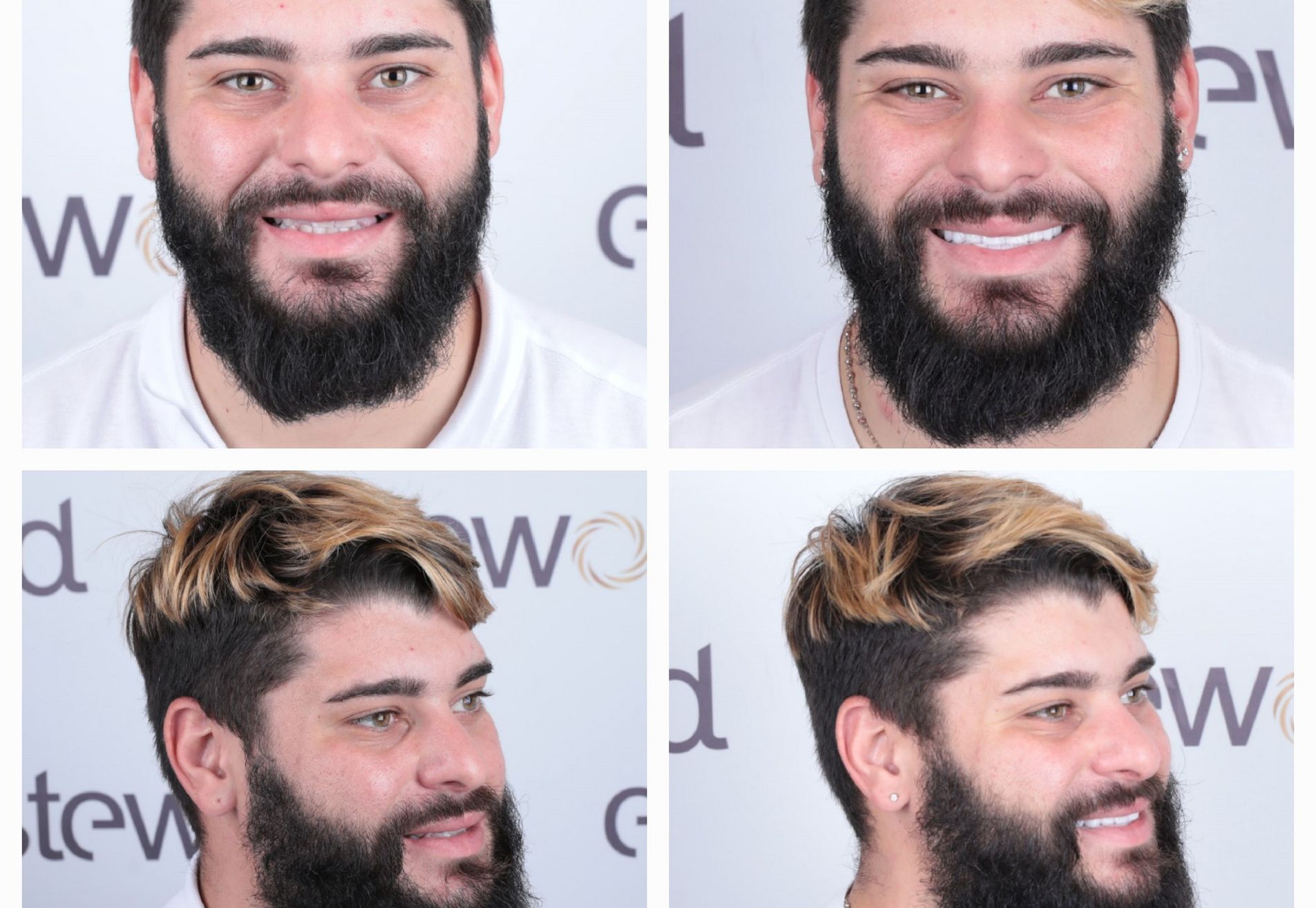 Sylvester kronen boven en onder