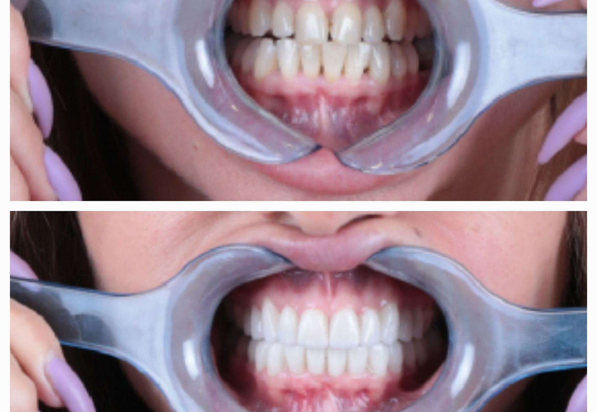 Katherina, geweldige ervaring gehad bij Esteworld Tandarts