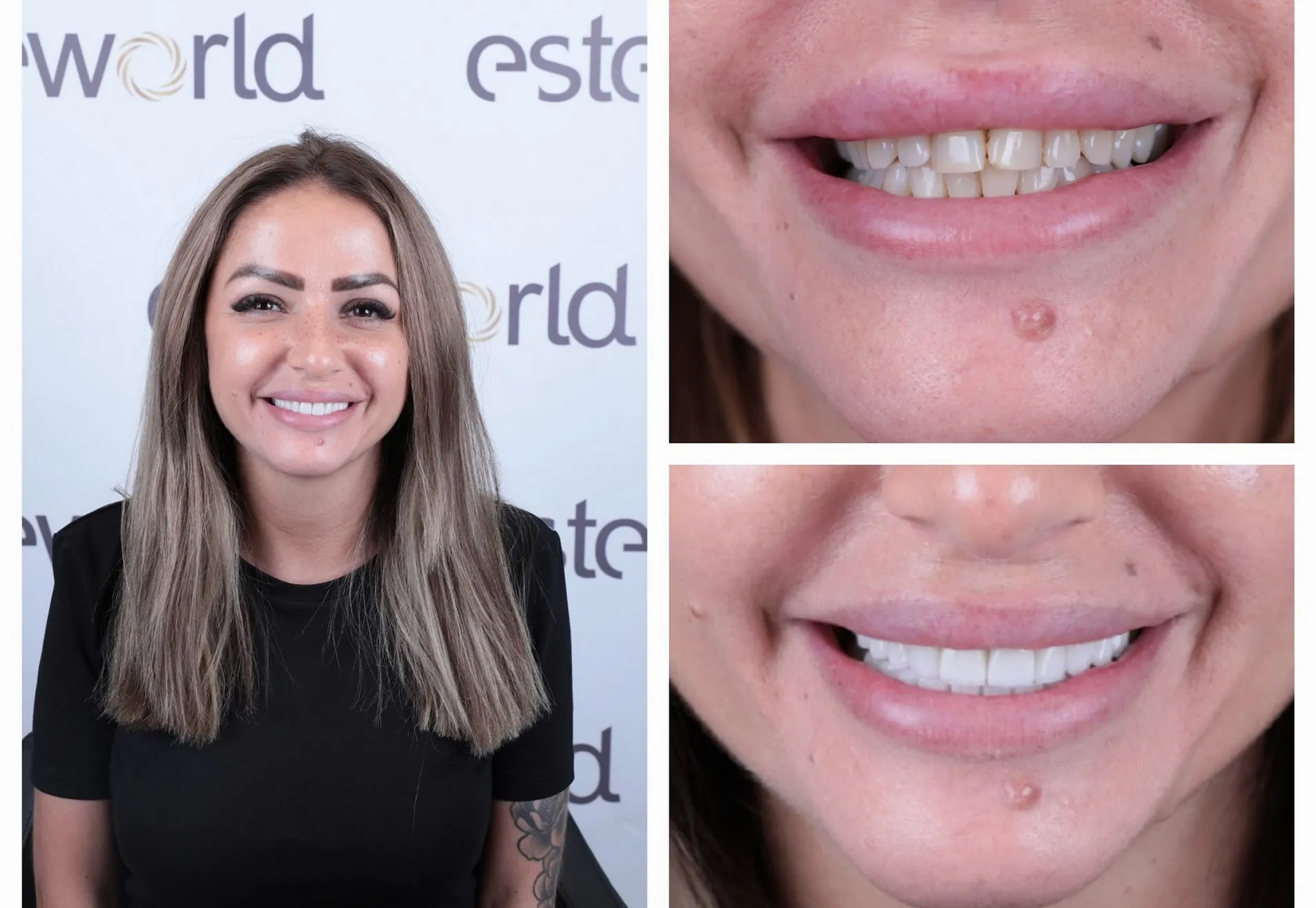 Katherina, geweldige ervaring gehad bij Esteworld Tandarts