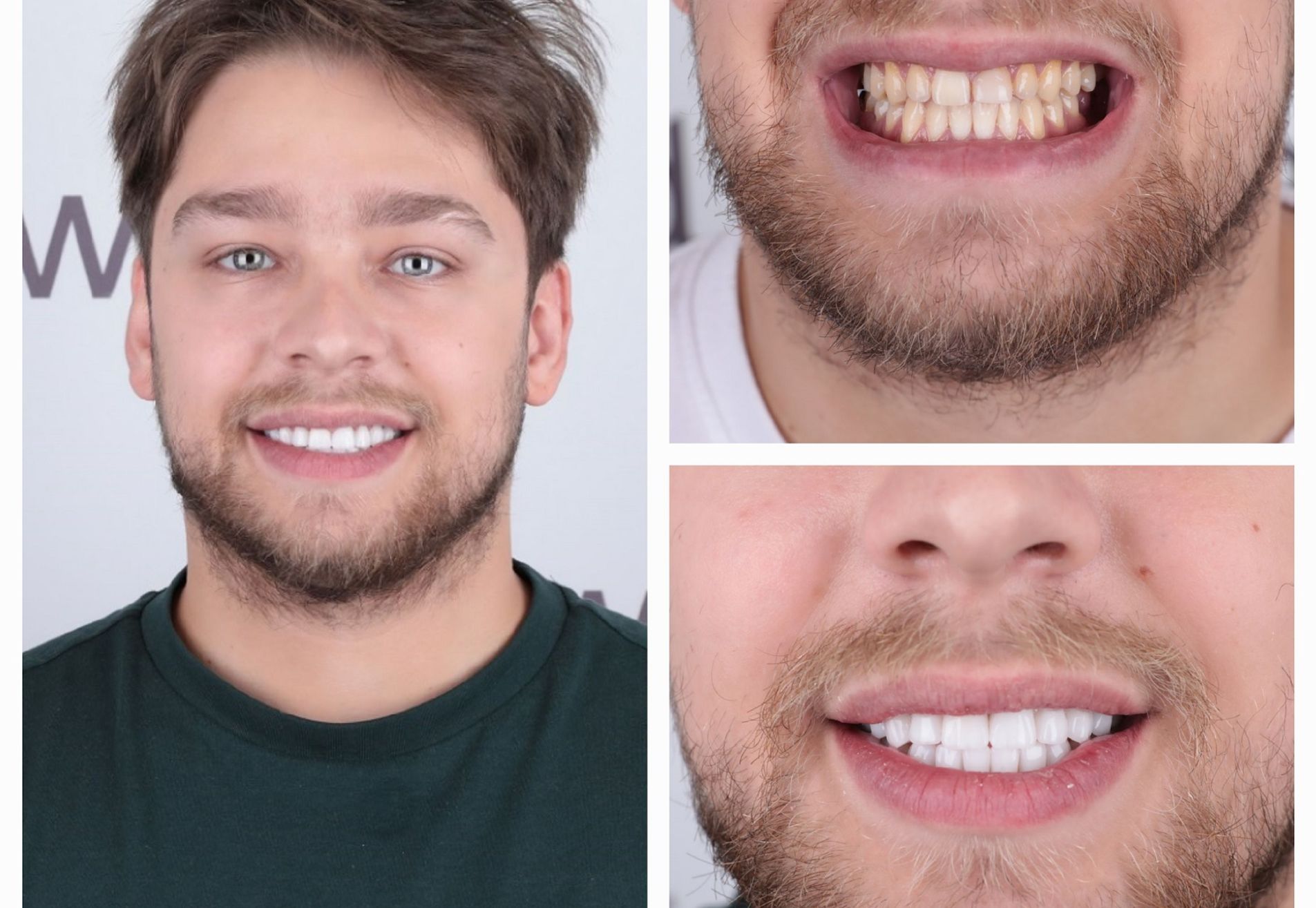 Danilo volledig nieuwe look met kronen