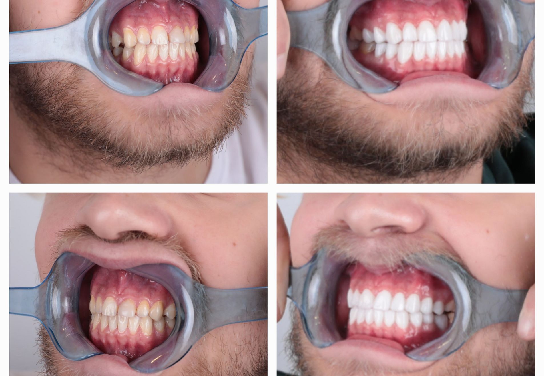 Danilo volledig nieuwe look met kronen