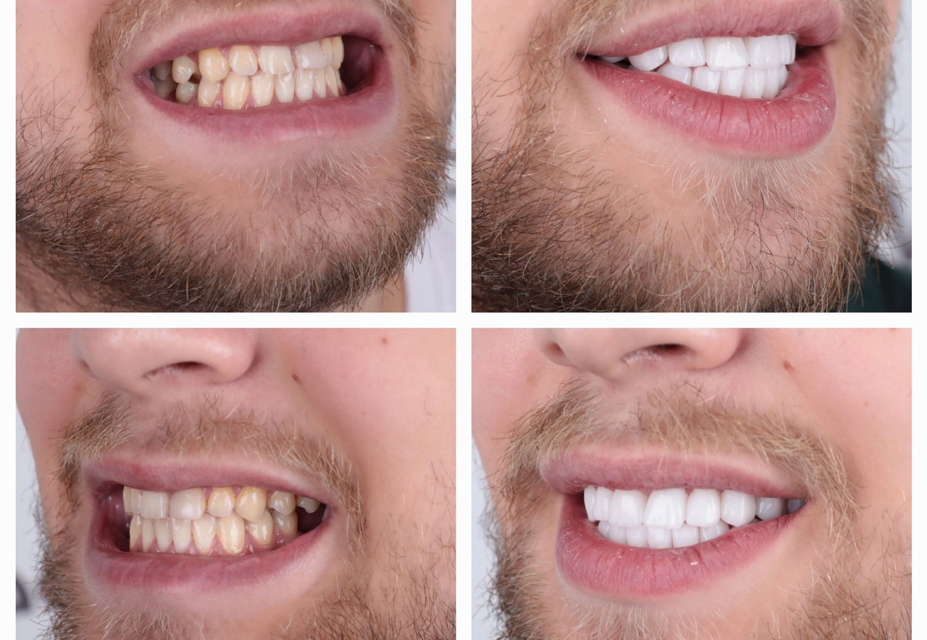 Danilo volledig nieuwe look met kronen