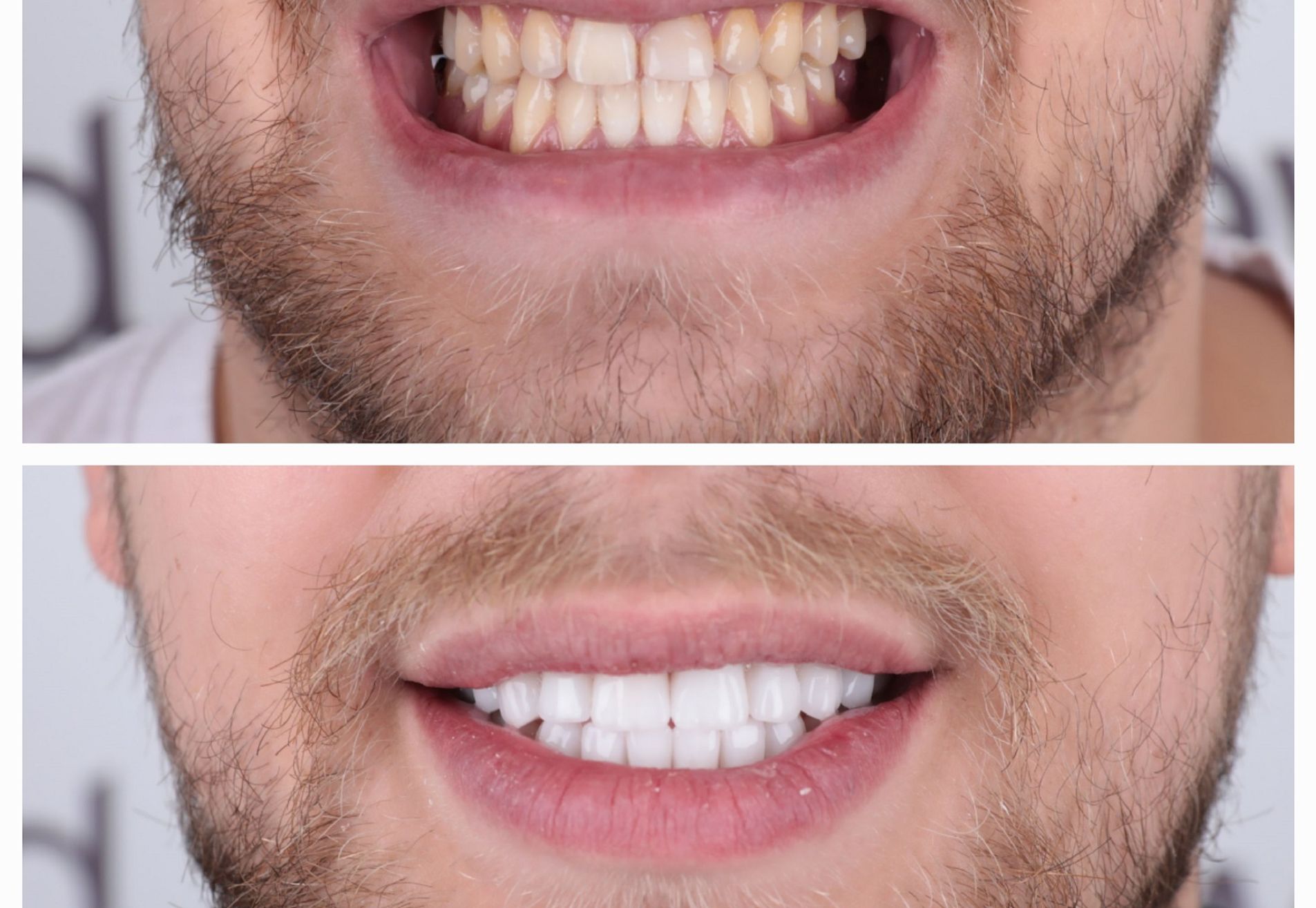 Danilo volledig nieuwe look met kronen