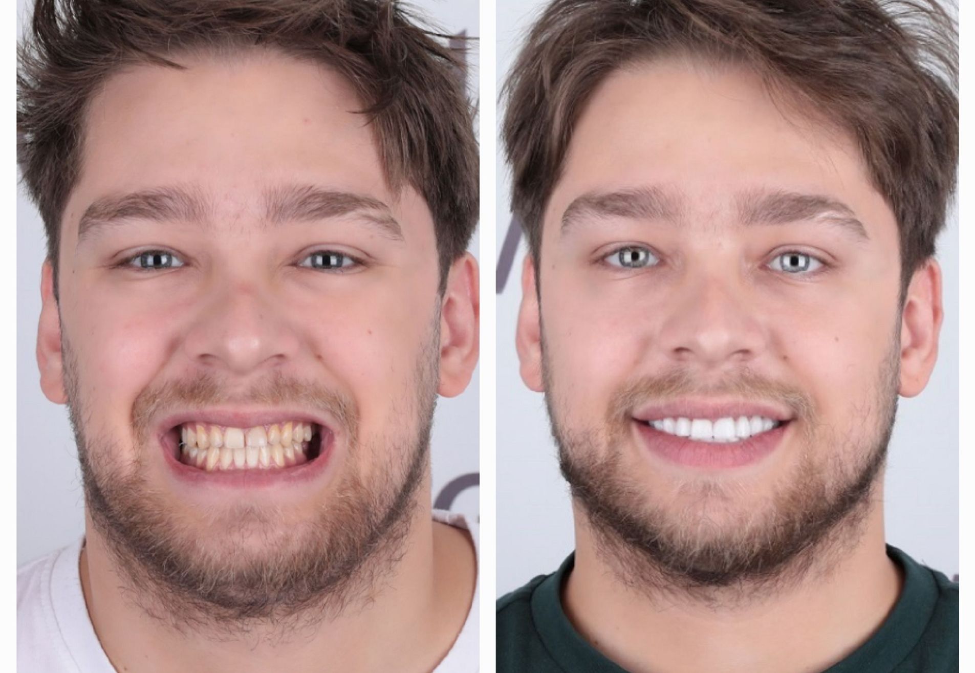 Danilo volledig nieuwe look met kronen