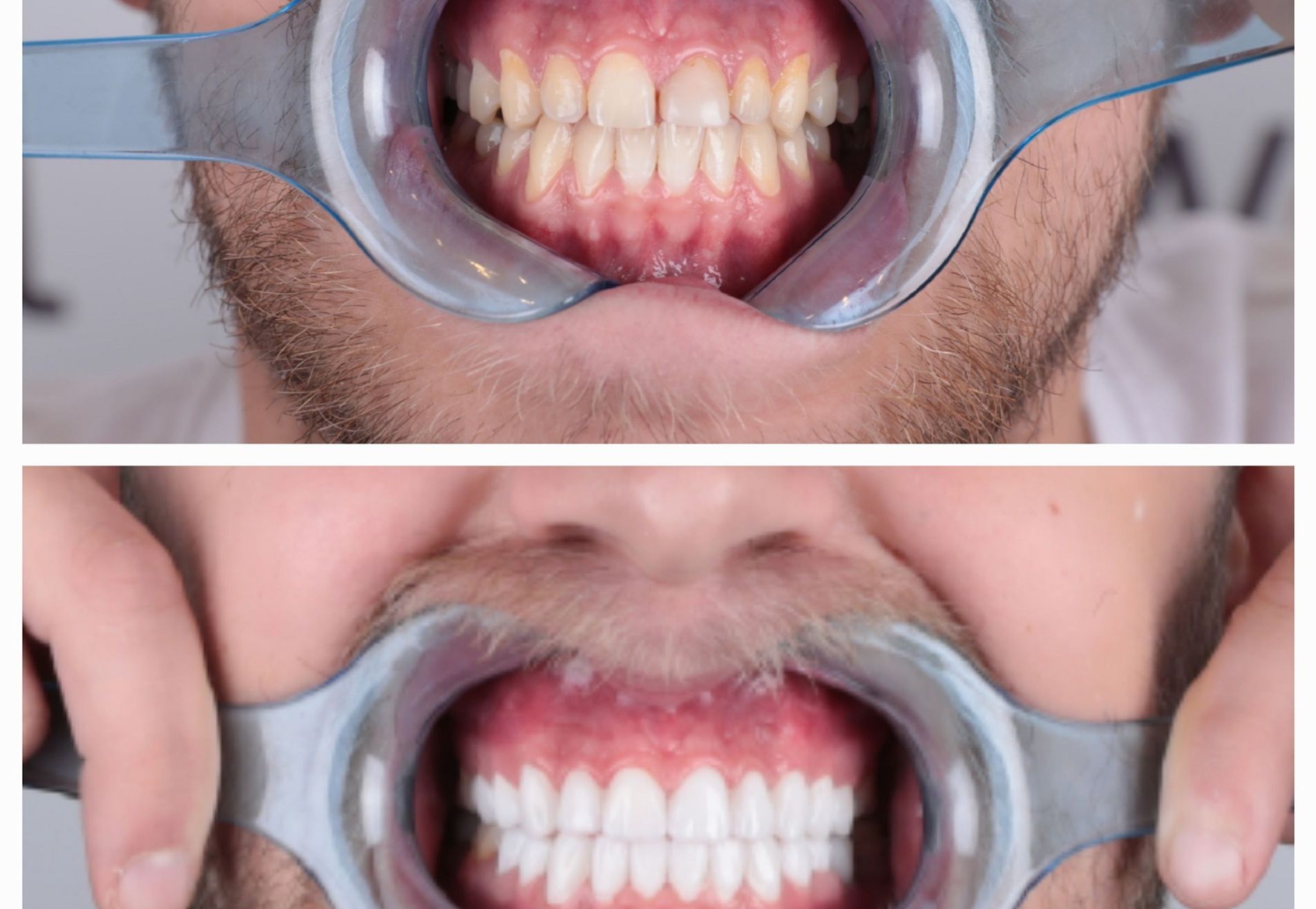 Danilo volledig nieuwe look met kronen