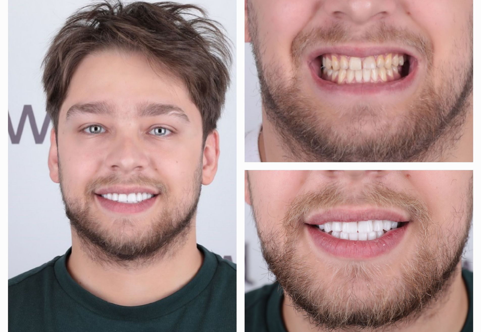 Danilo volledig nieuwe look met kronen